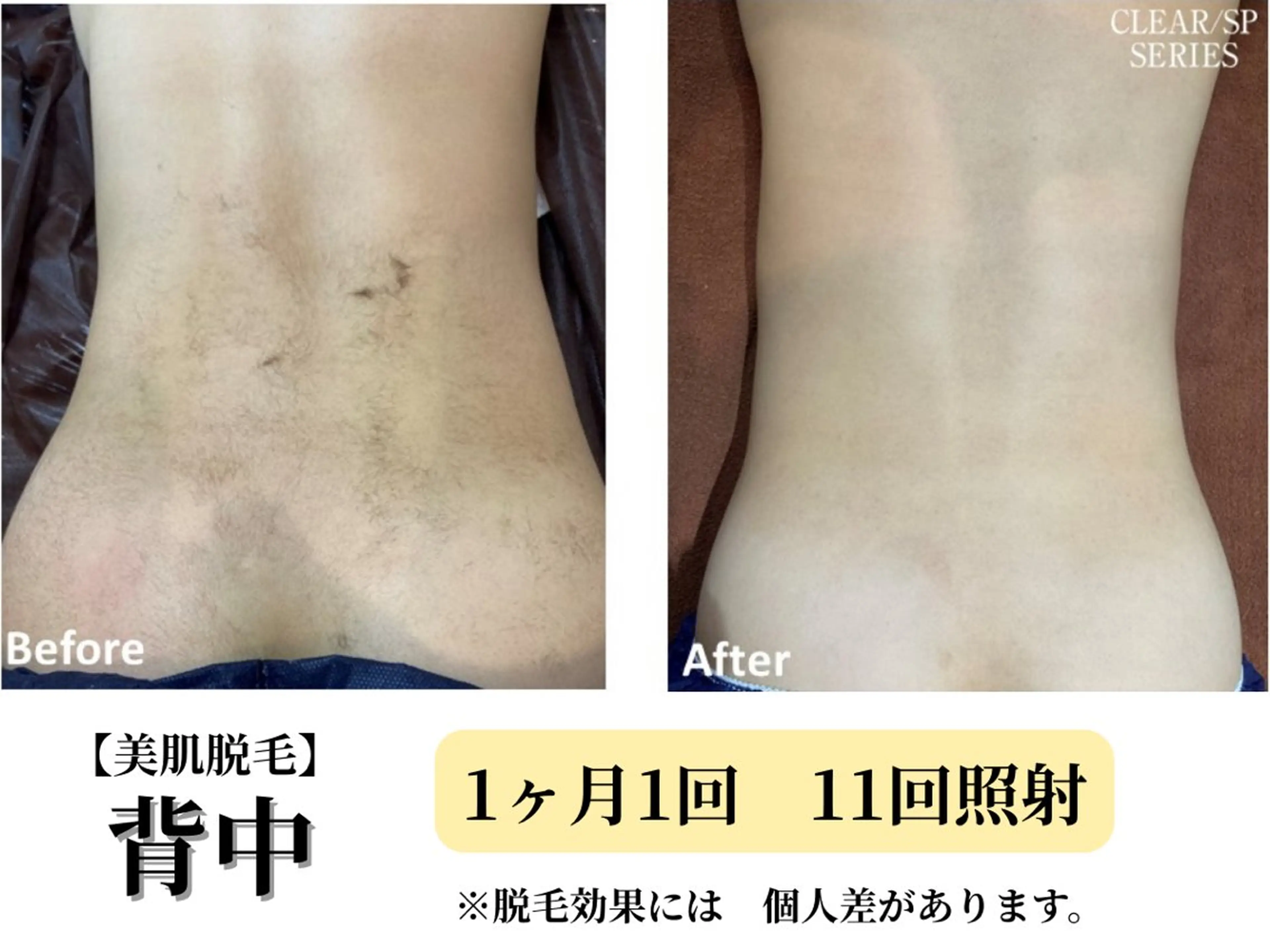 脱毛 Belle White所属・本格痩身＊透明美肌 BelleWhiteのエステ・リラクイメージ