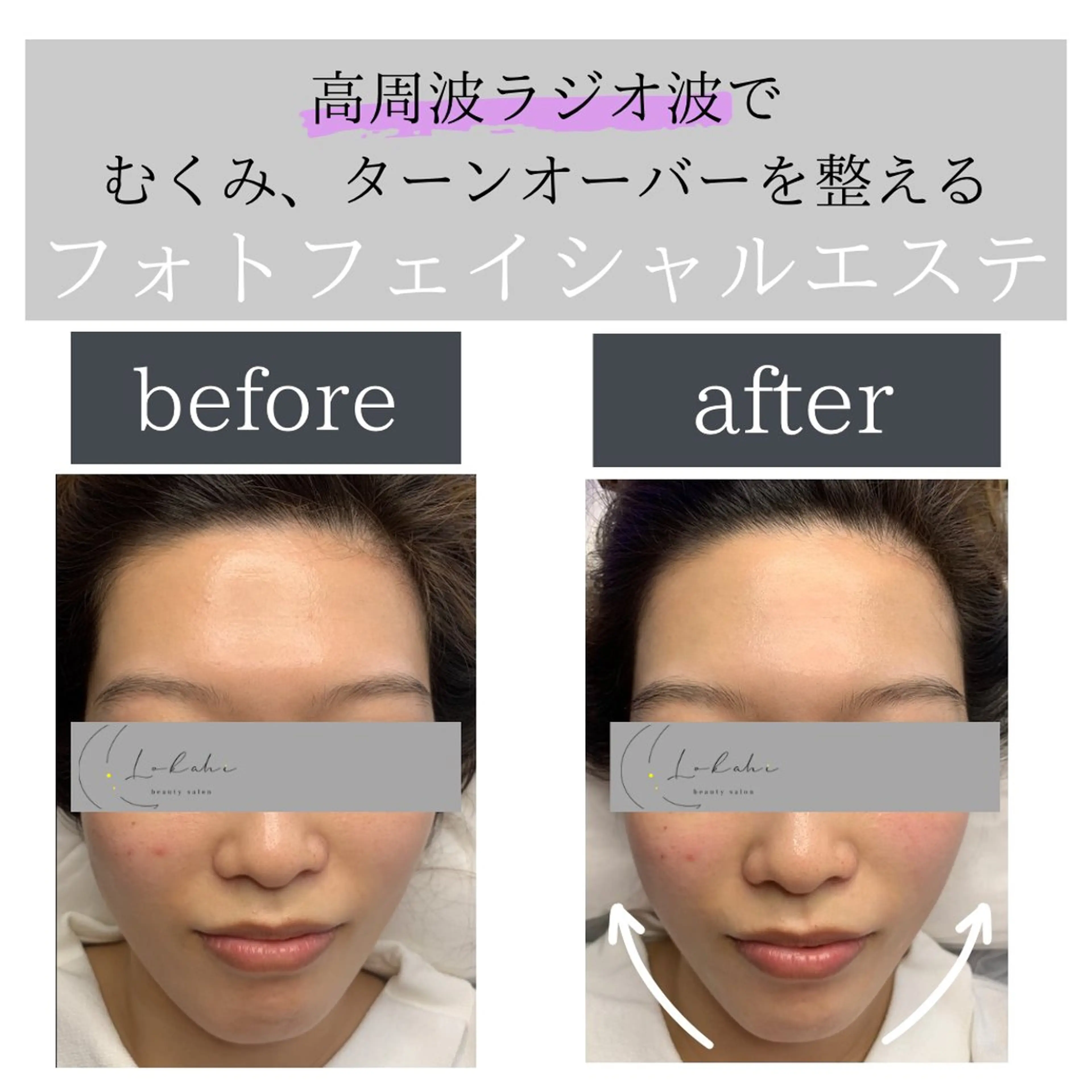 脱毛サロン Lokahiのエステ・リラクイメージ