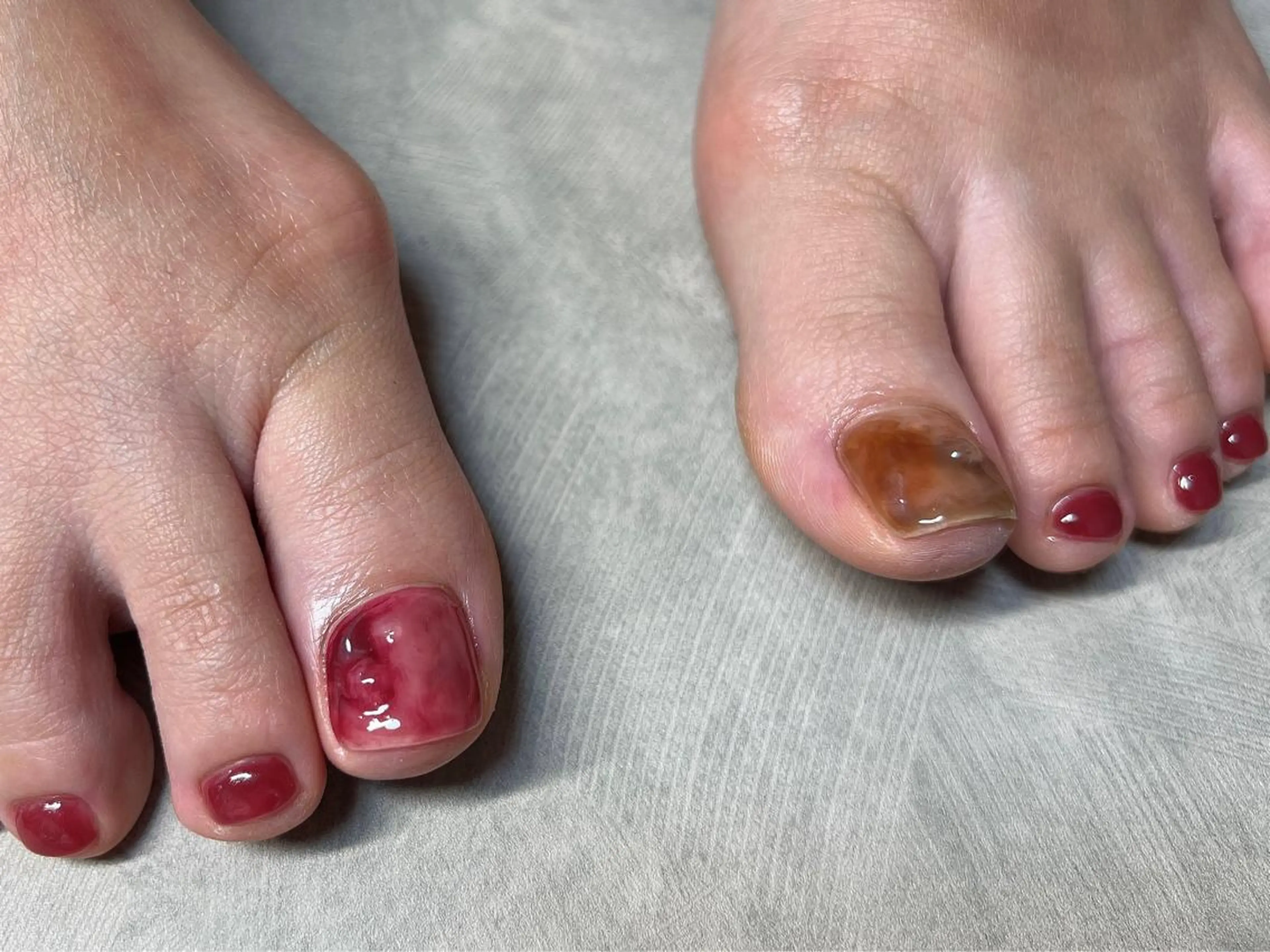 ネイル フットネイル Lavish nailのネイルデザイン