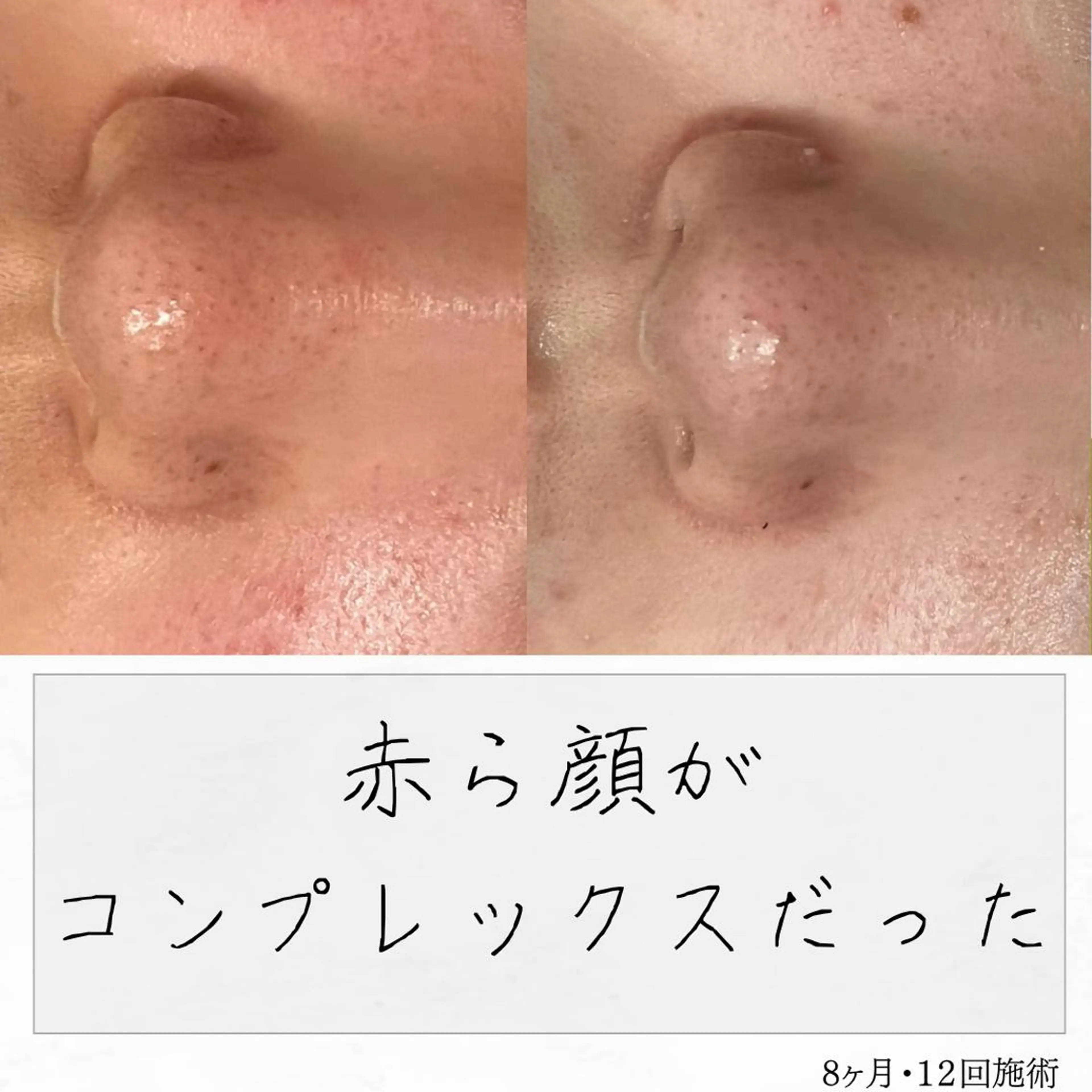 ニキビ経験者が施術 する専門サロン🌻のエステ・リラクイメージ