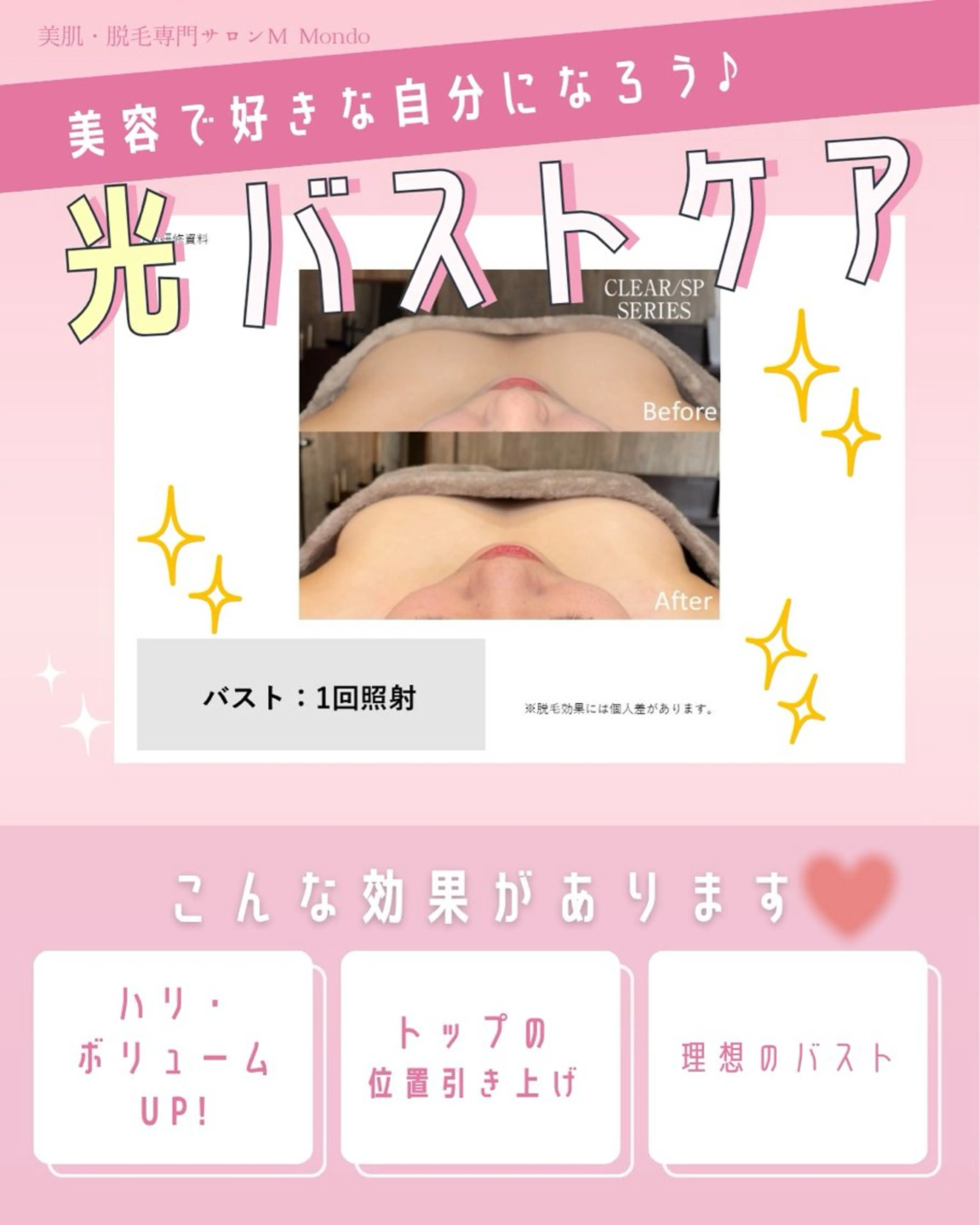 脱毛×肌質改善 M Mondoのエステ・リラクイメージ