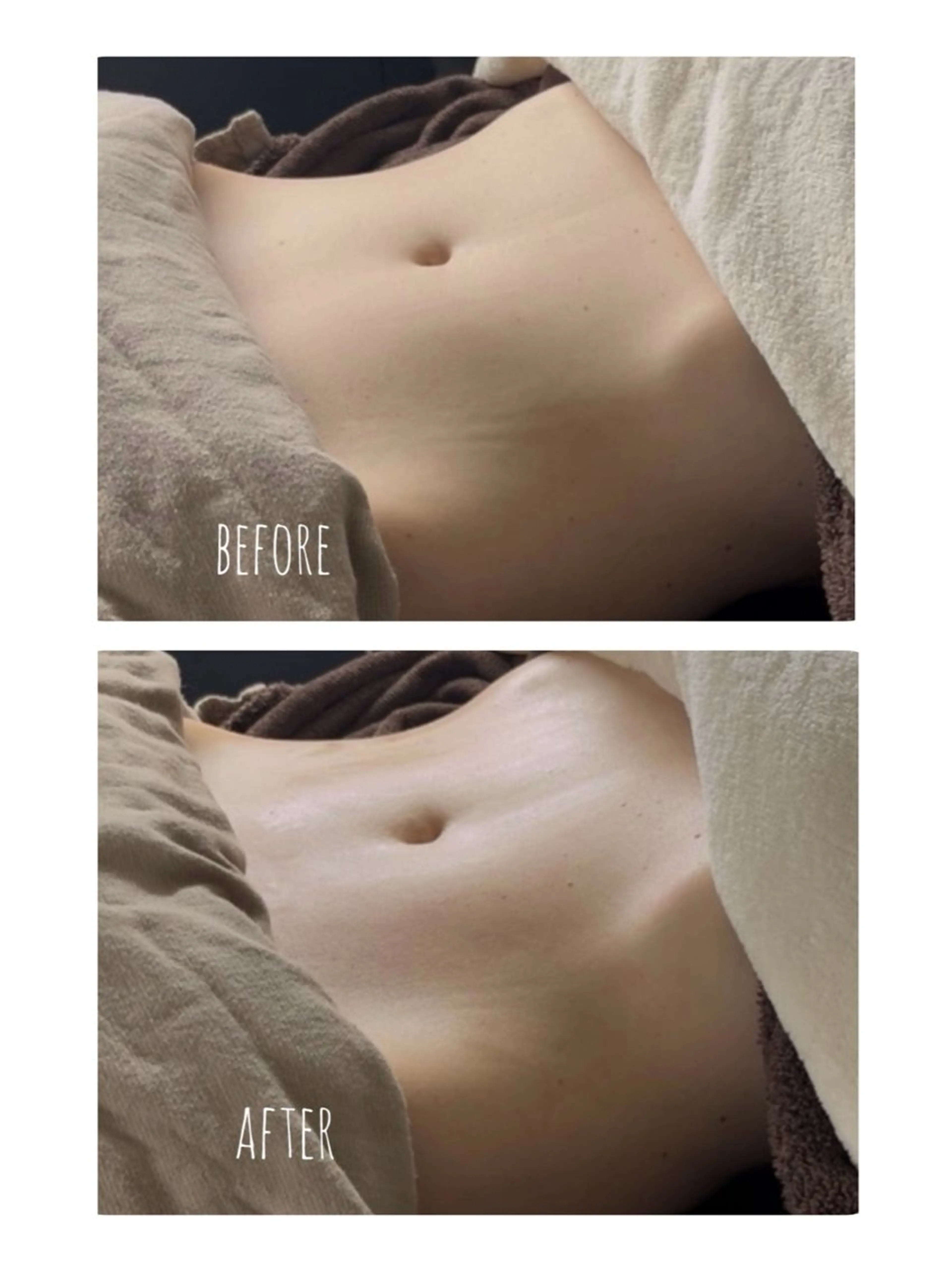 腸揉み15分の写真