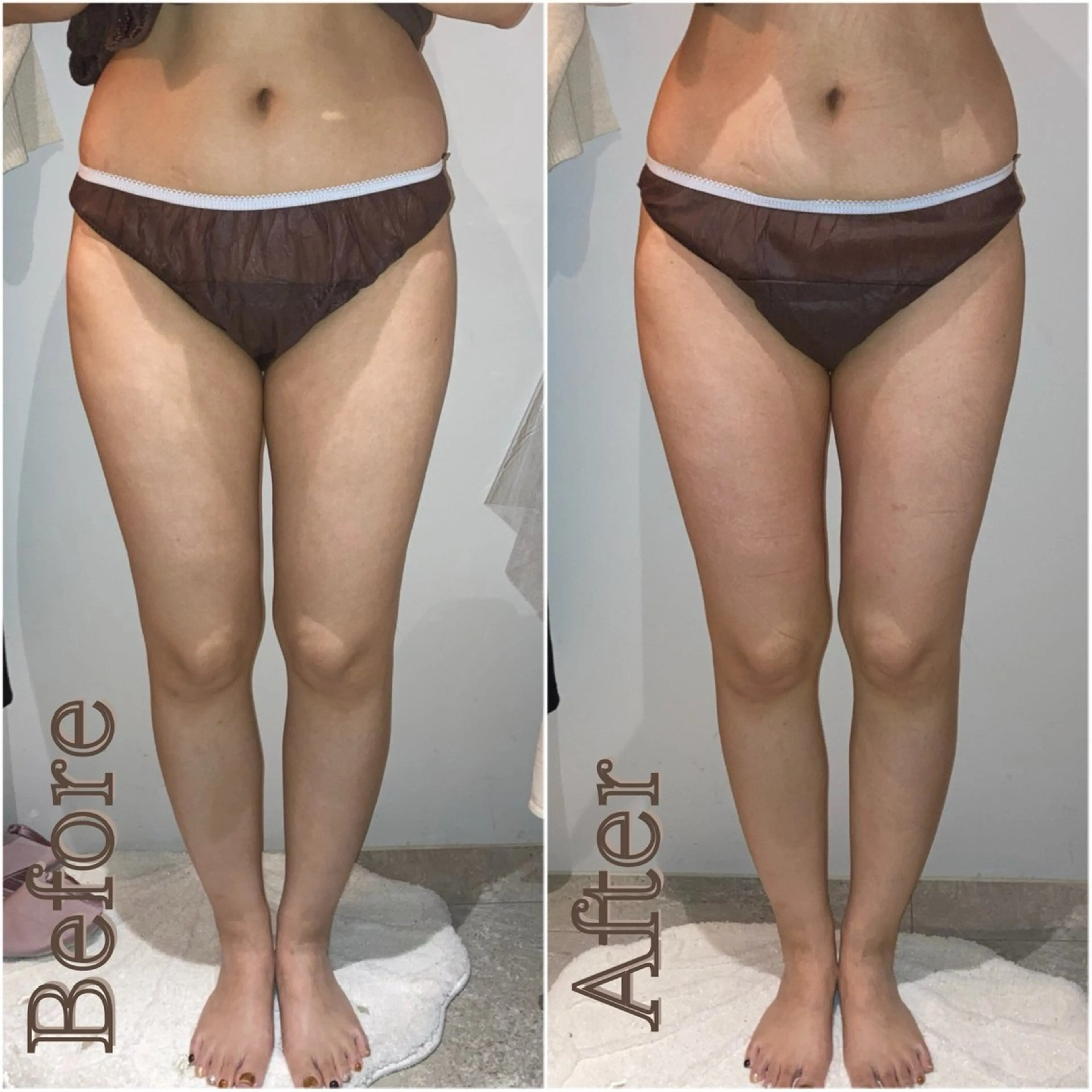 エステ 津村 夏実のエステ・リラクイメージ