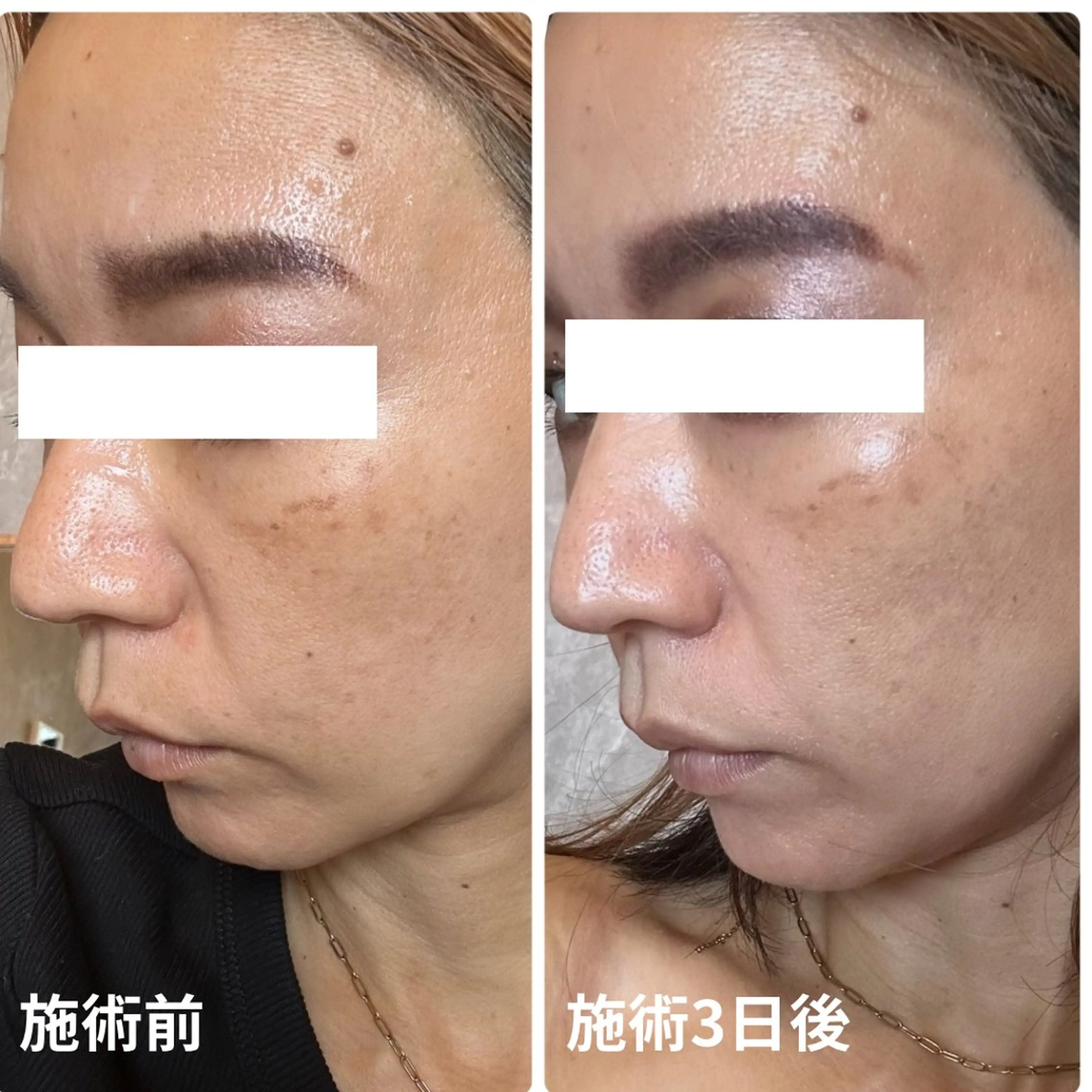 yellow.所属・yellow💛【 脱毛&フェイシャル】のエステ・リラクイメージ