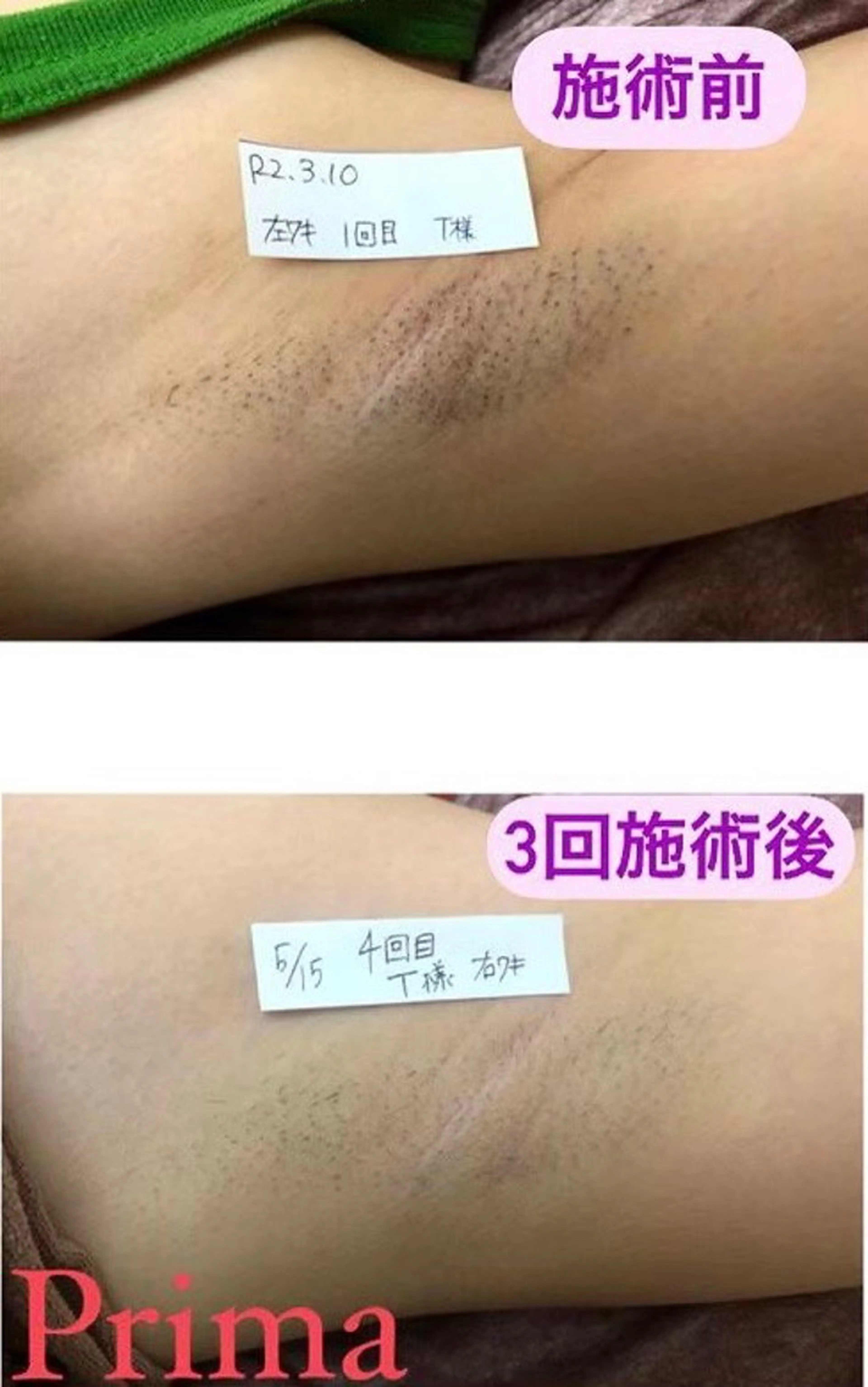 Prima（プリマ） 名古屋駅本店のエステ・リラクイメージ