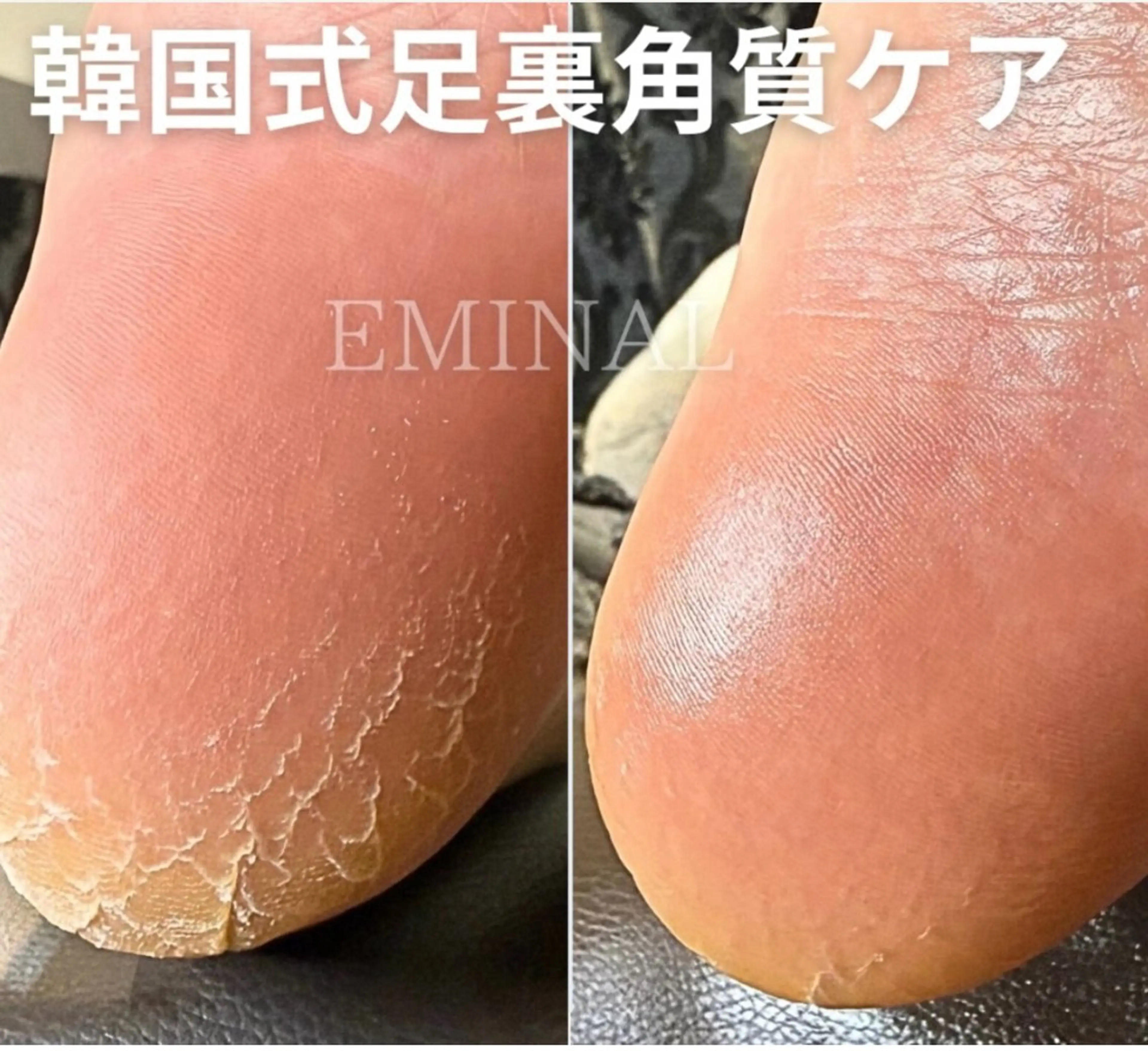 リラク Rieko EMINAL恵比寿のネイルデザイン