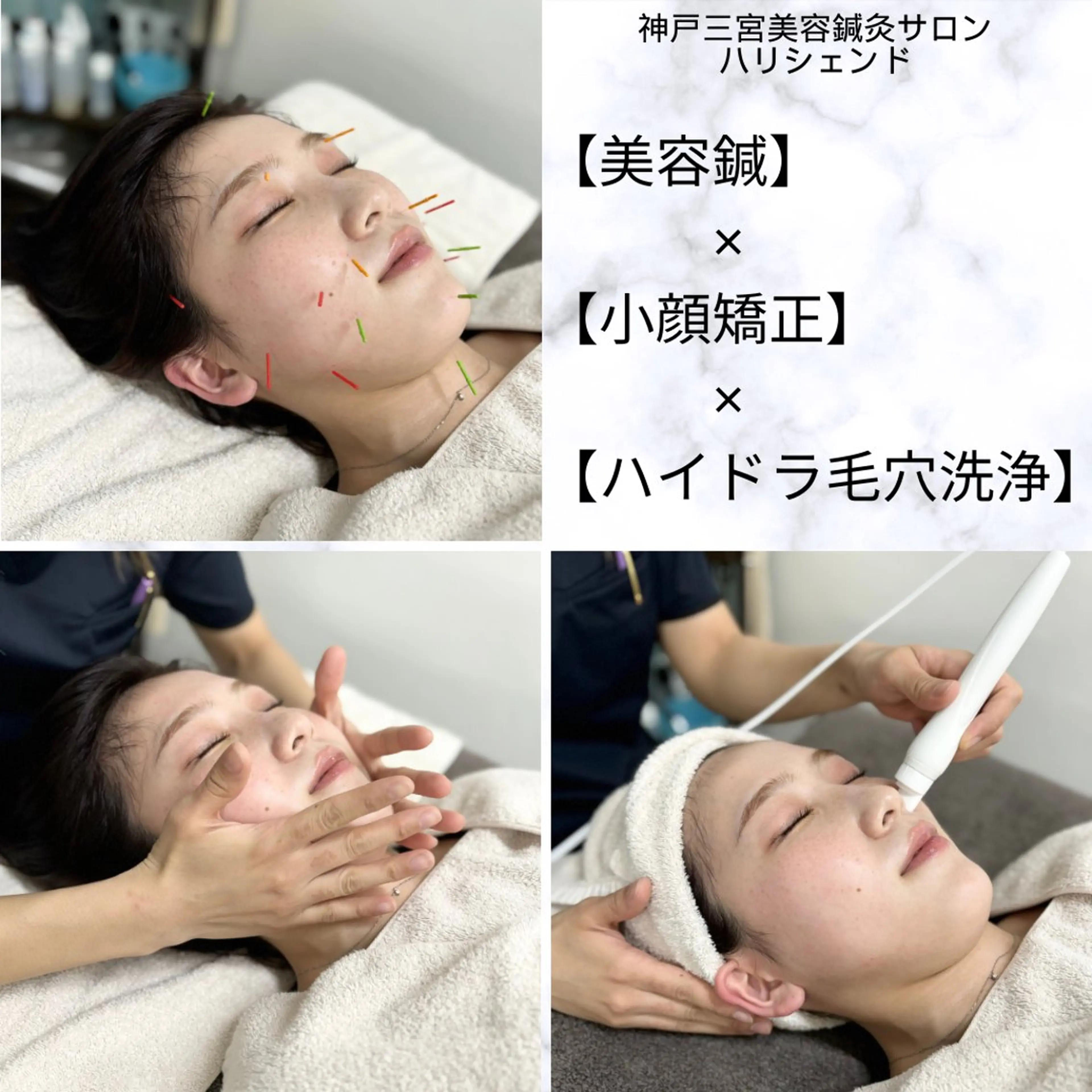 エステ リラク 美容鍼・小顔矯正 ハリシェンドのエステ・リラクイメージ