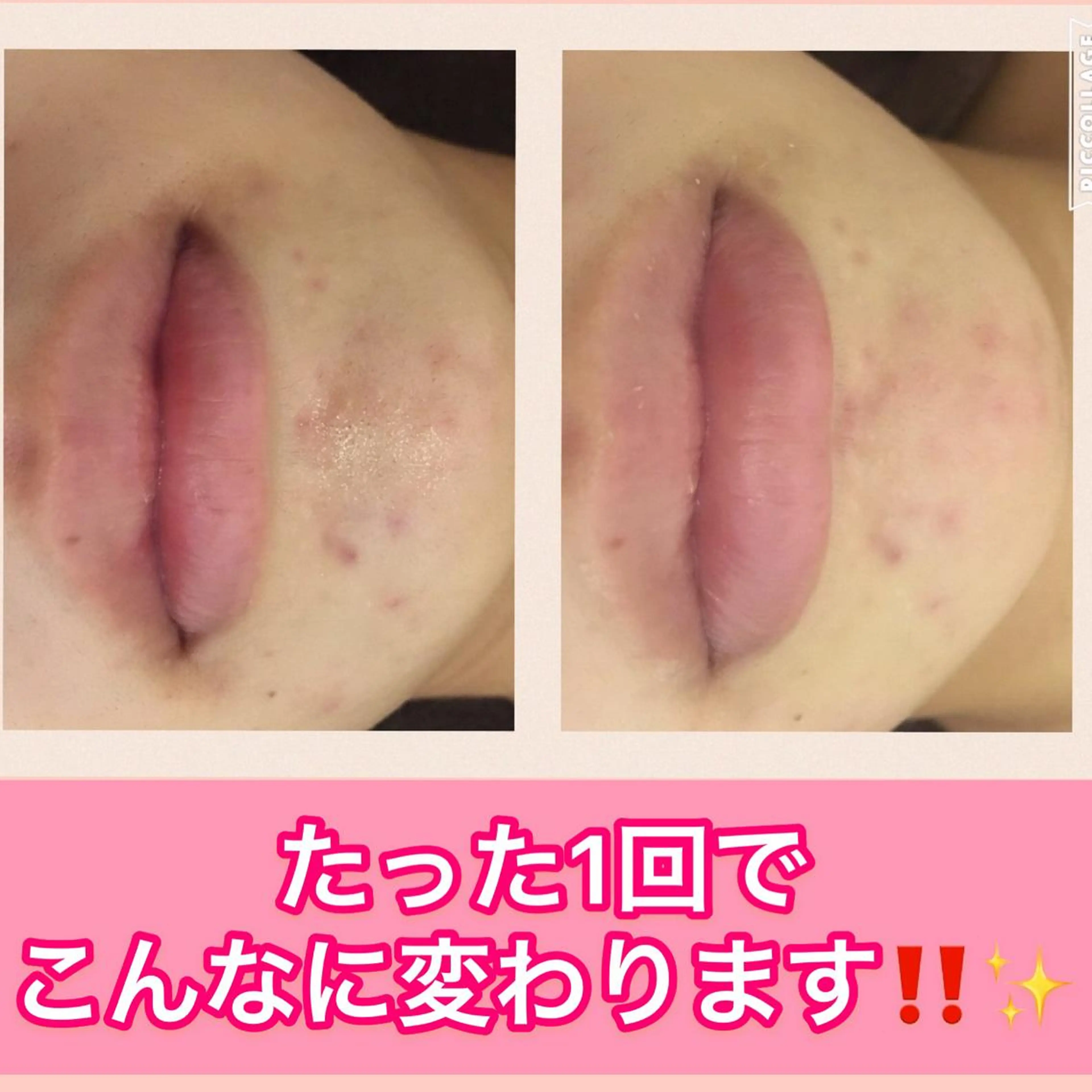 ミディアム カラー パーマ ヘアアレンジ メンズ キッズ ネイル マツエク・マツパ ニキビ・肌質改善専門 ♡人生が変わるサロンのエステ・リラクイメージ