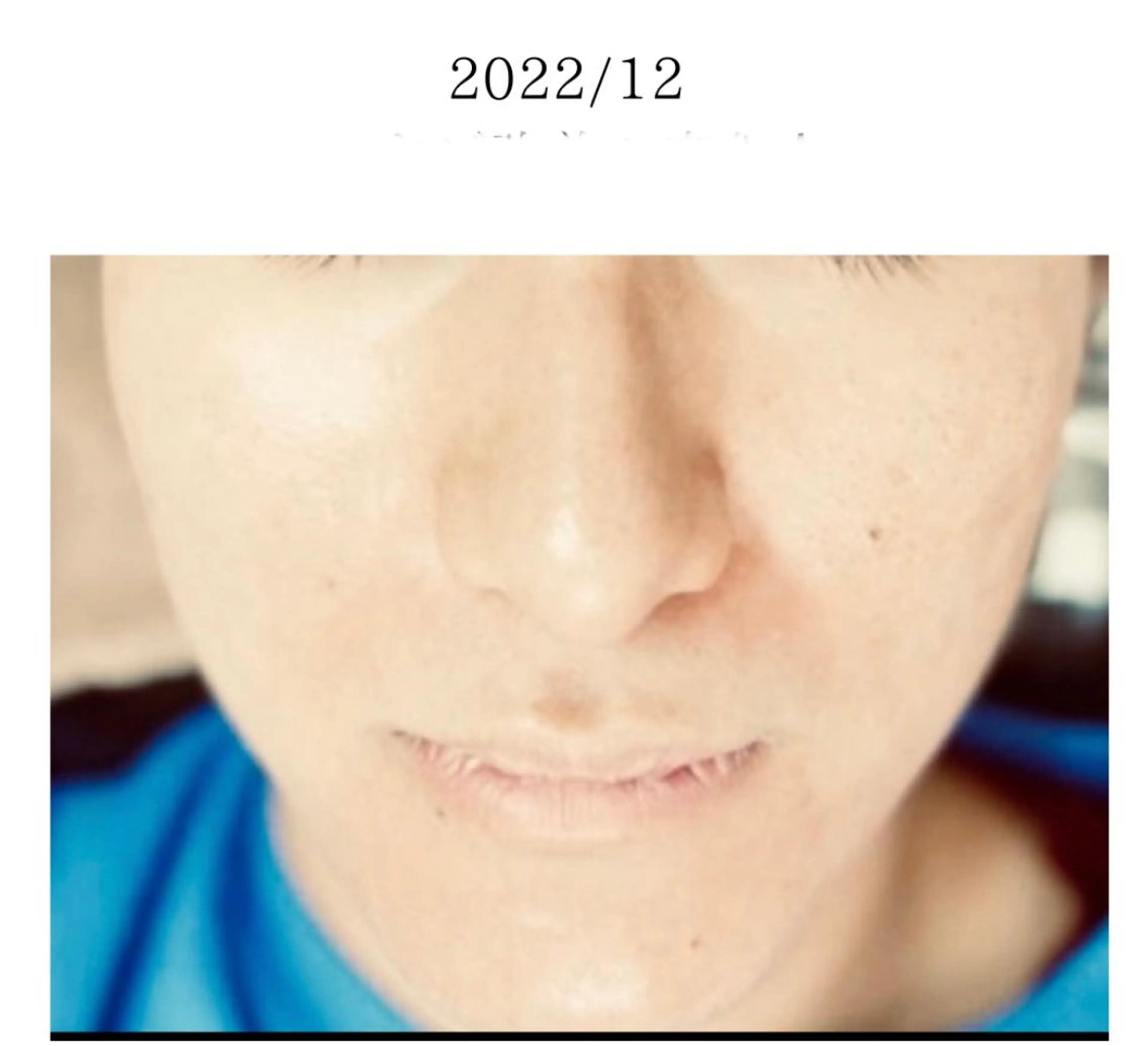 ニキビ専門サロン縁樹 鈴木真樹のエステ・リラクイメージ