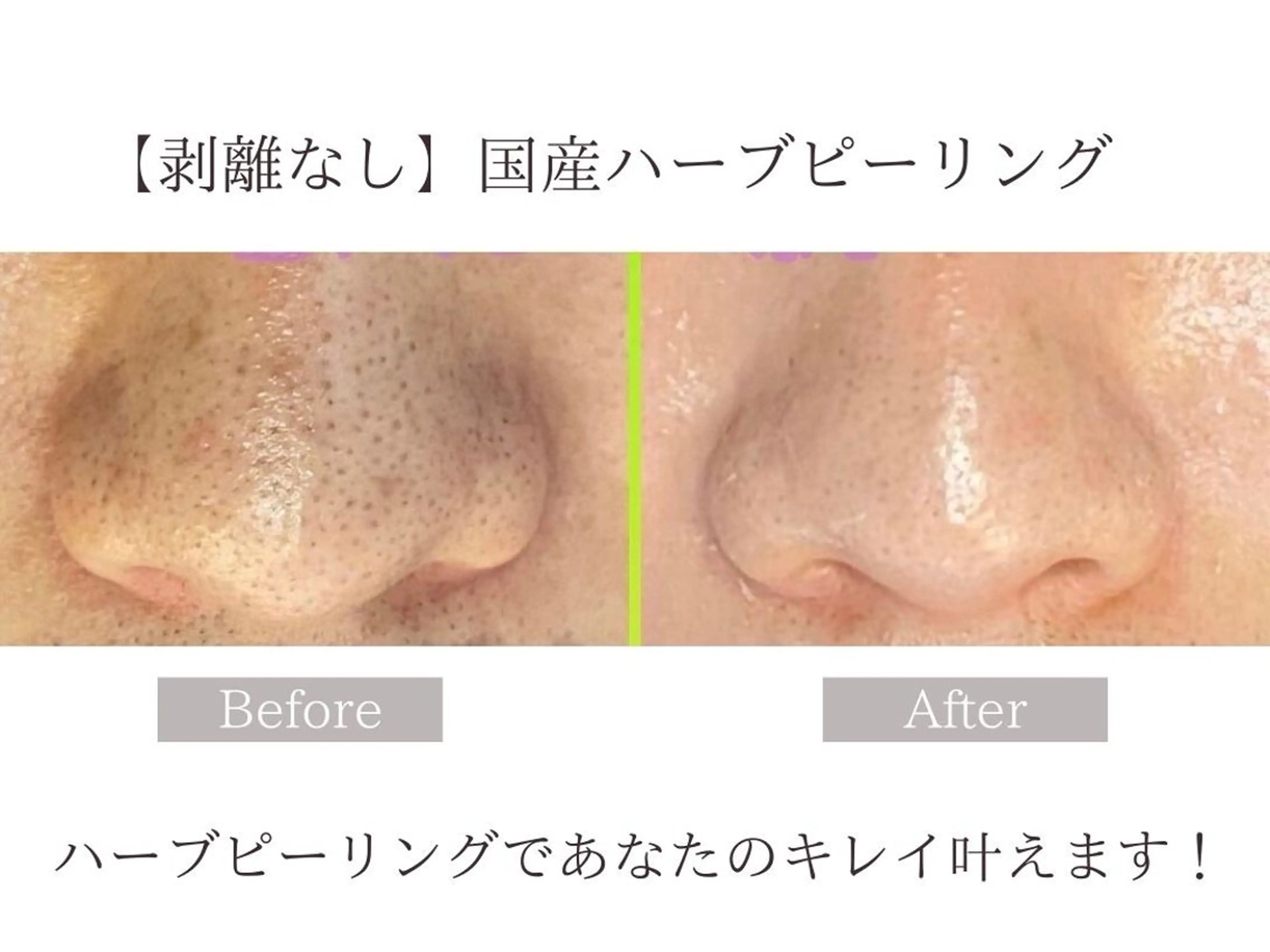 肌質改善サロン renew/ｳｴｷのエステ・リラクイメージ