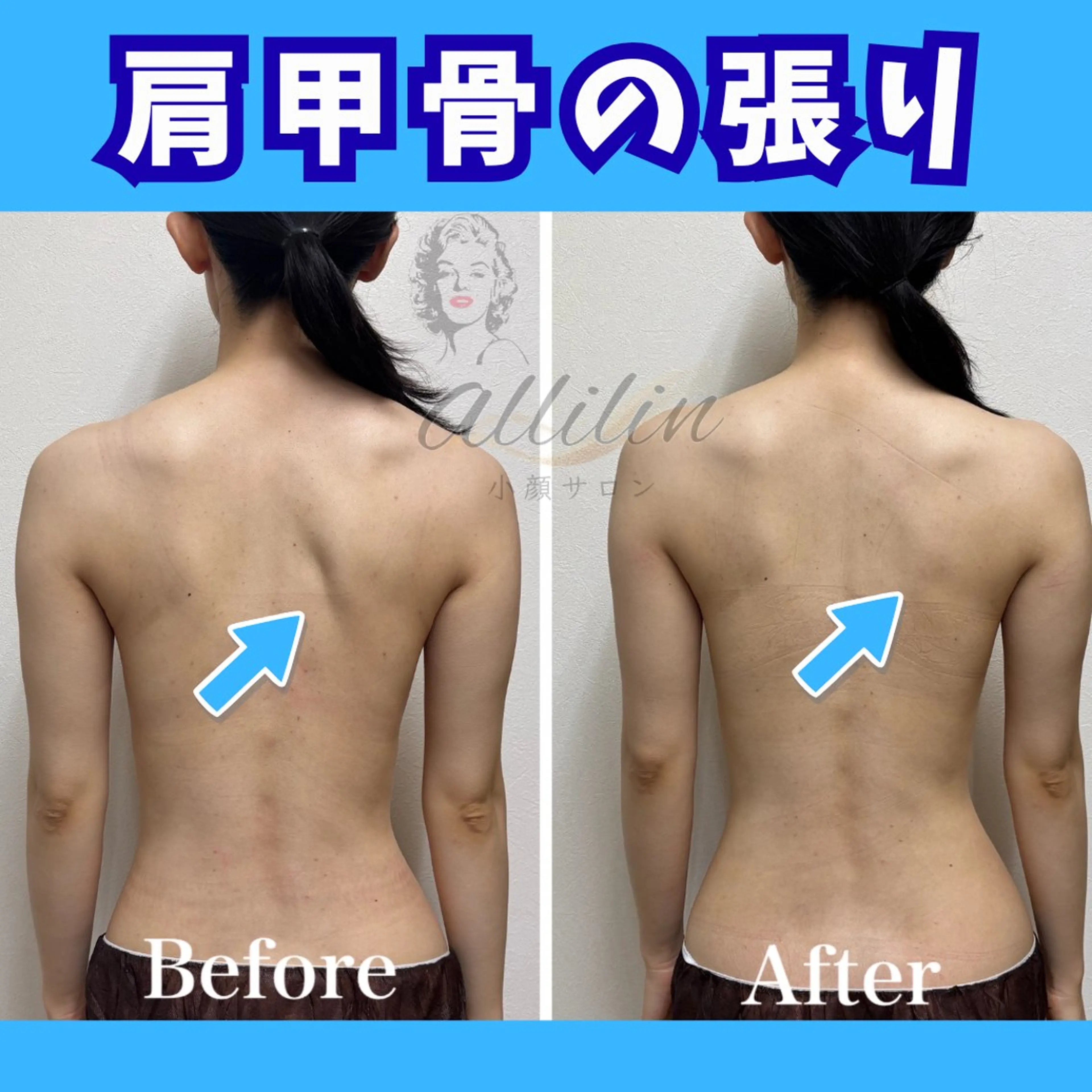 💎小顔ｻﾛﾝ アリリン銀座💎のエステ・リラクイメージ