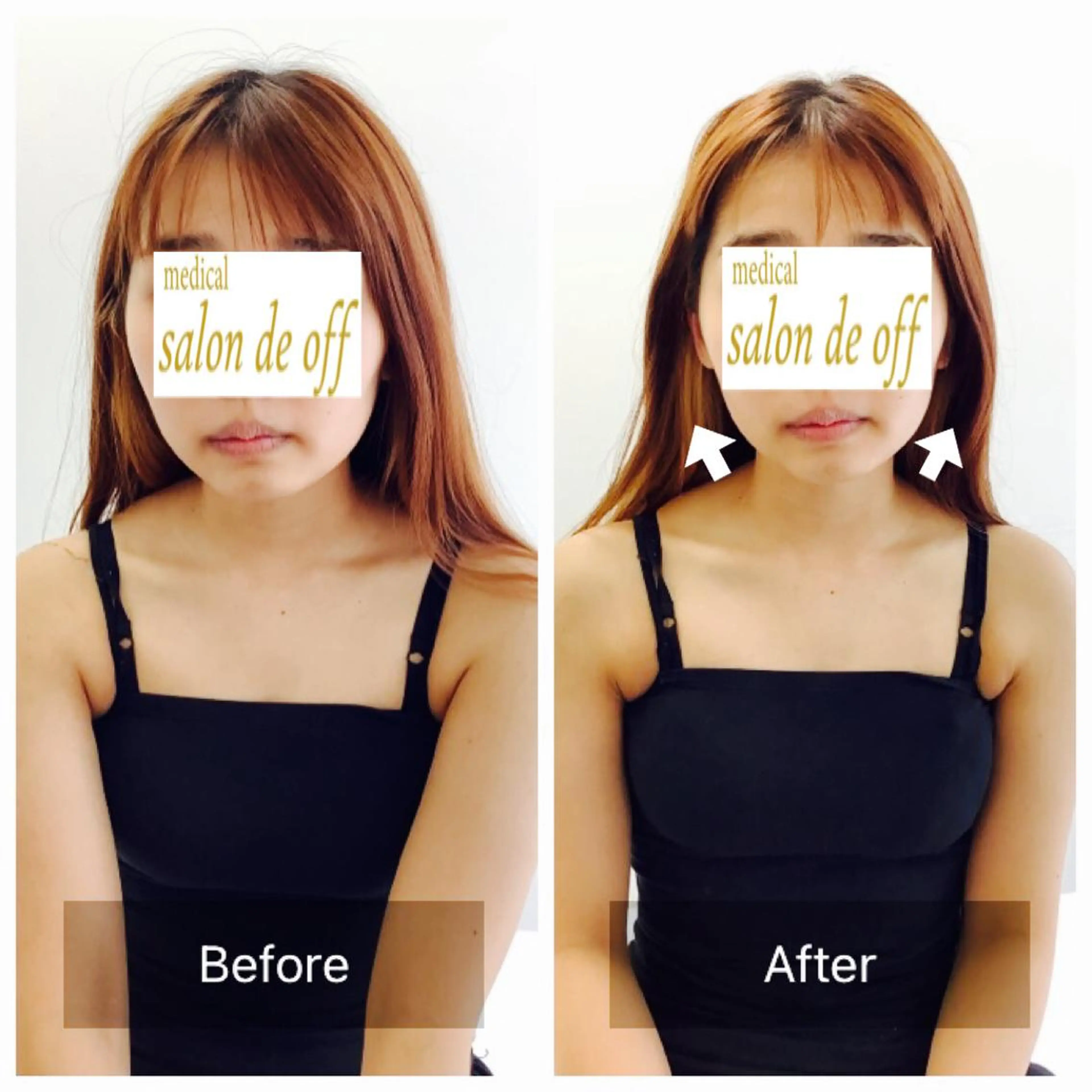 ハリサロンドオフ 美容鍼灸×小顔整体のエステ・リラクイメージ