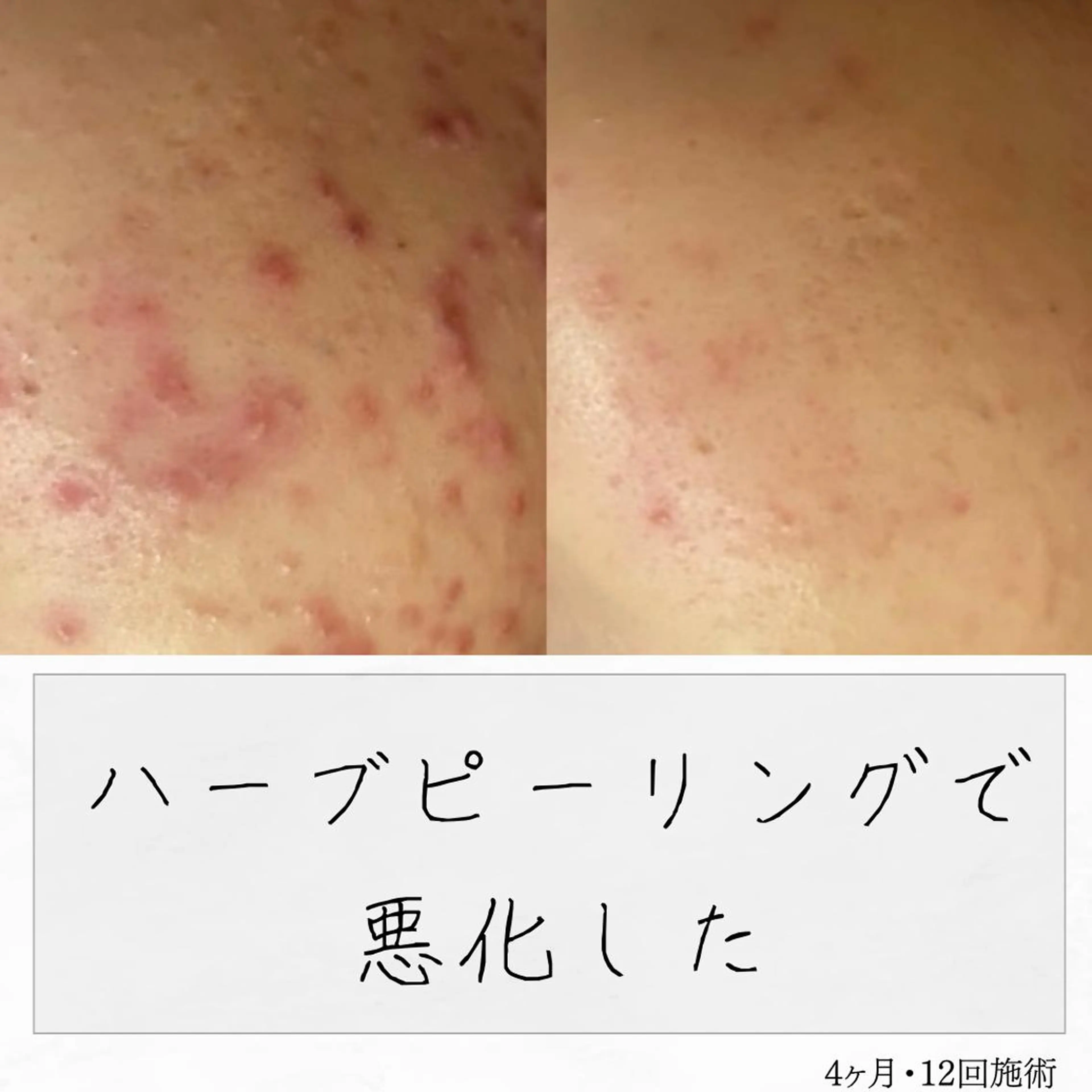 ニキビ経験者が施術 する専門サロン🌻のエステ・リラクイメージ