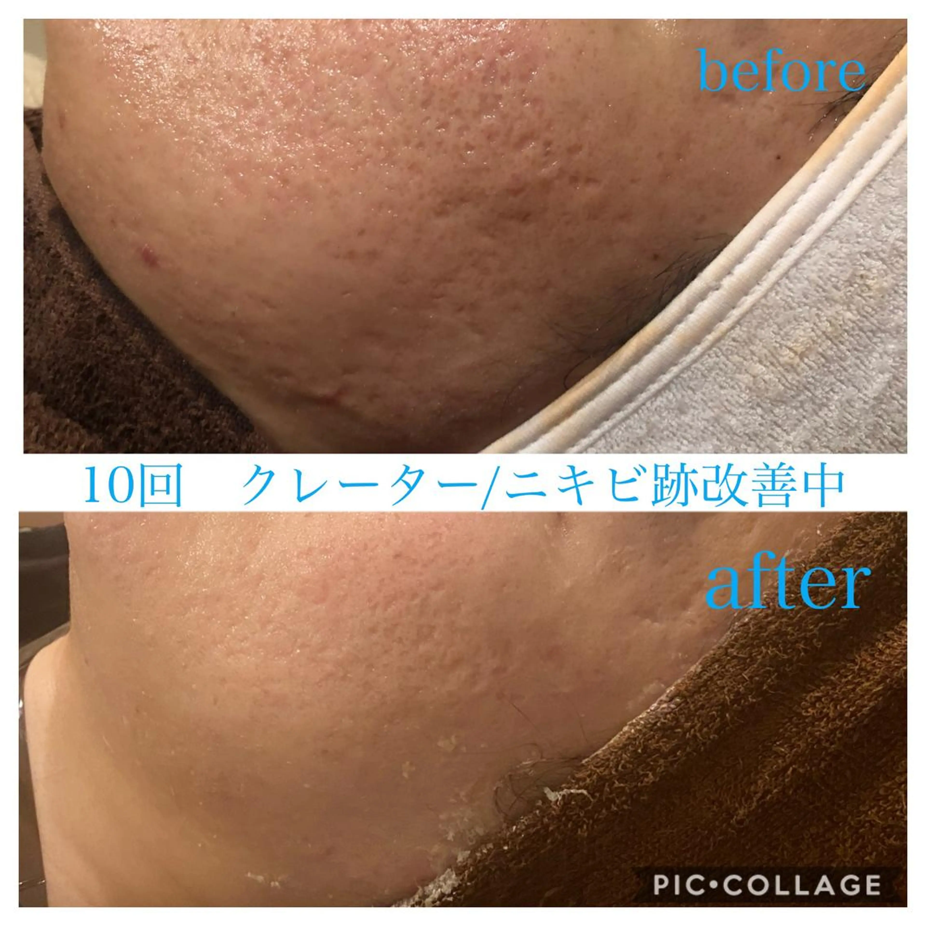ロング カラー パーマ ヘアアレンジ メンズ キッズ ネイル マツエク・マツパ エステ リラク EnsorClair 代表 野口真央のエステ・リラクイメージ