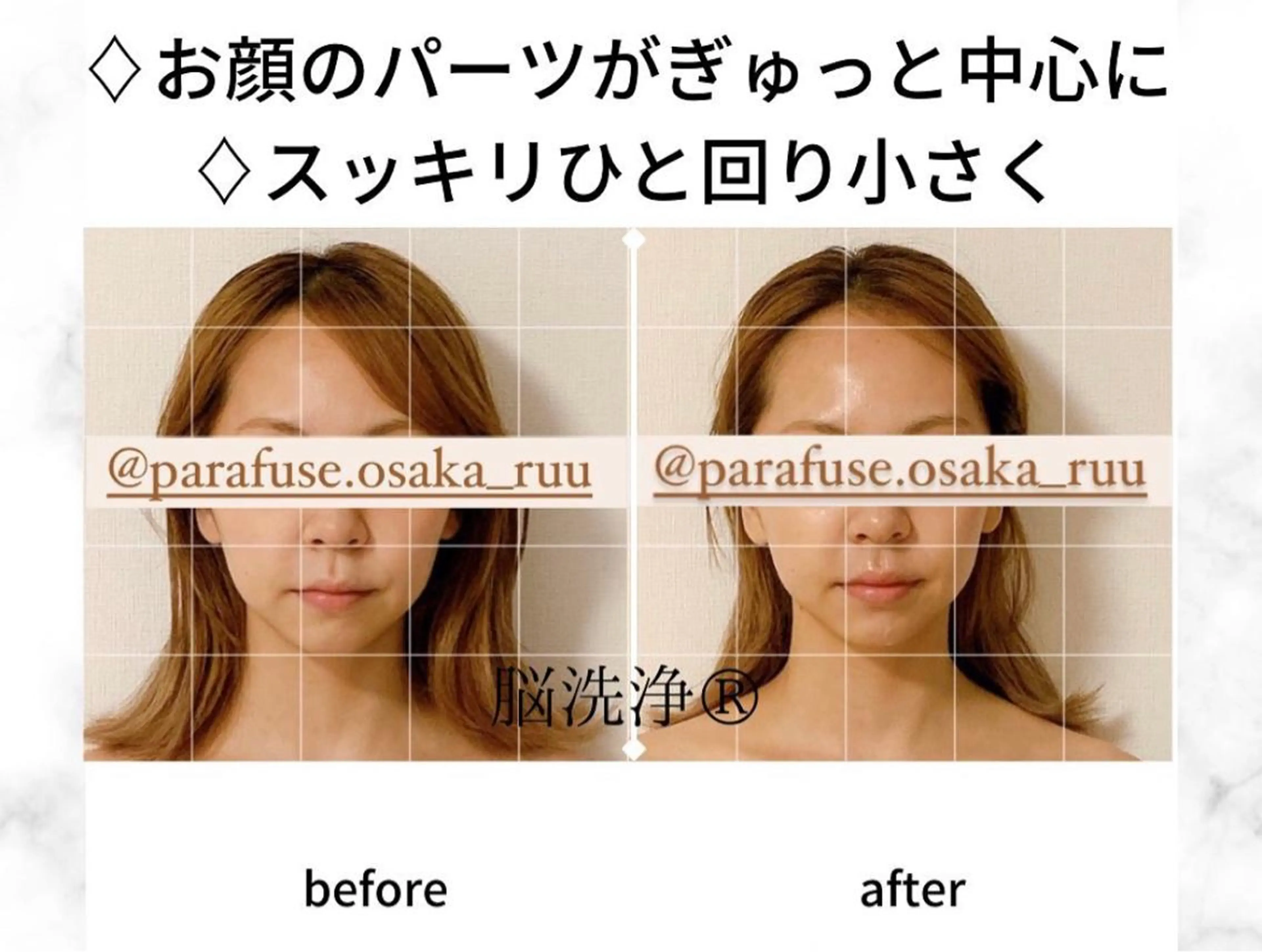 【頭痛、睡眠改善】 salon RUUのエステ・リラクイメージ