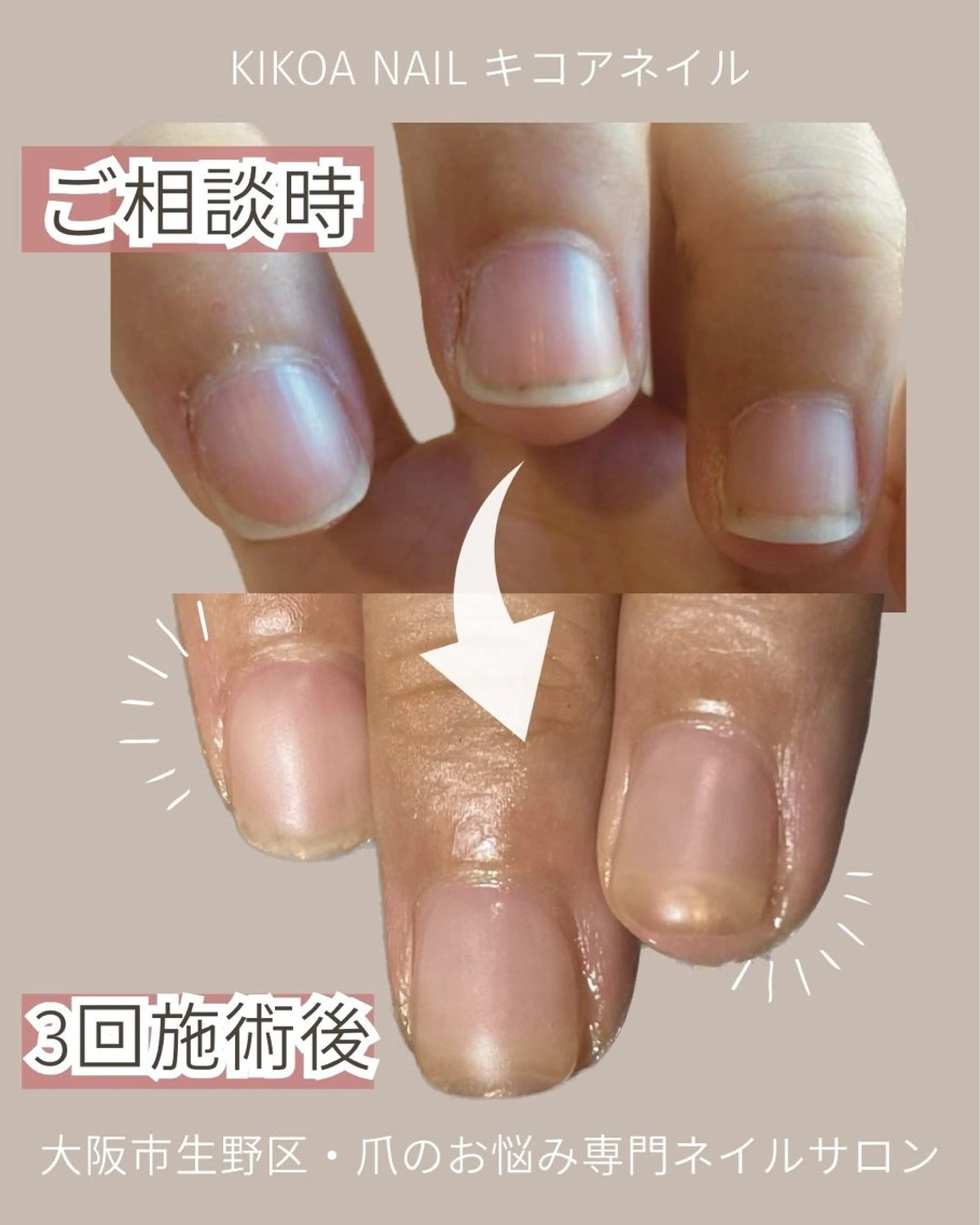 ネイル KIKOA NAIL キコアネイルのネイルデザイン