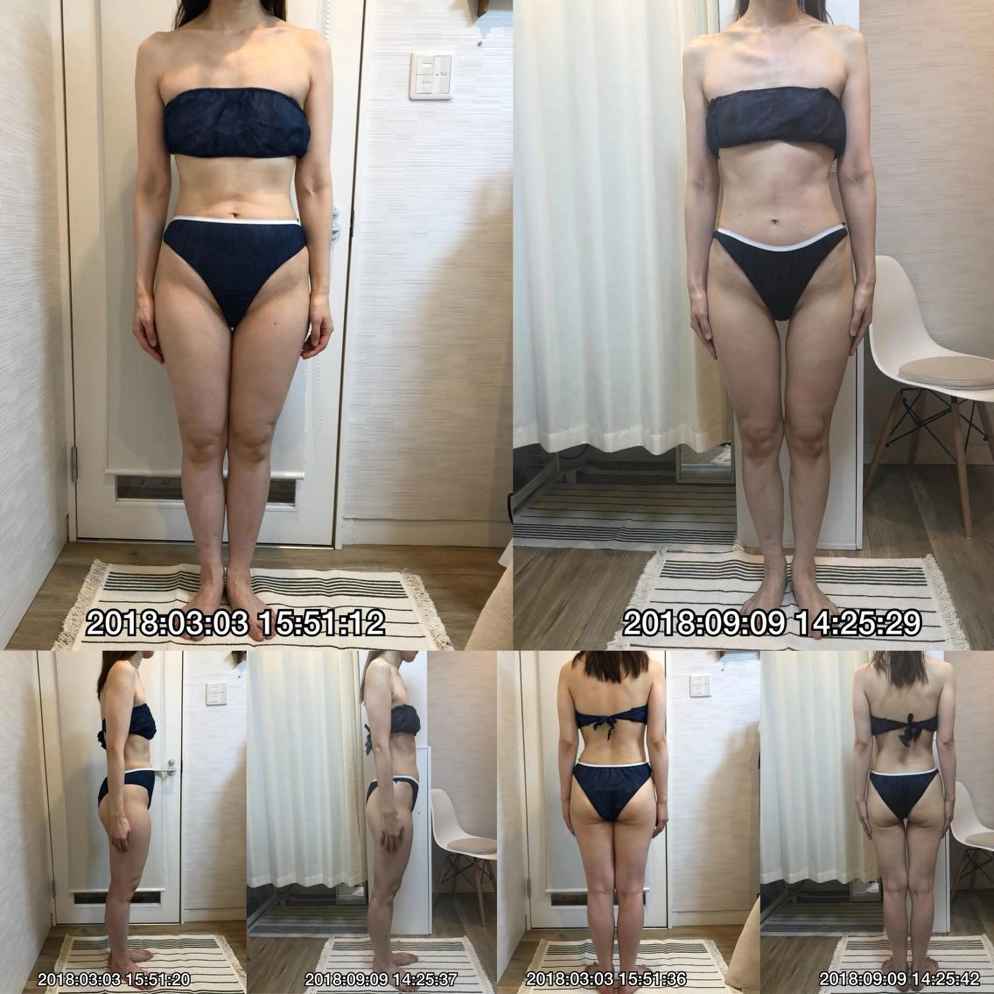 ROOM.S ｜脱毛｜美肌｜ボディのエステ・リラクイメージ