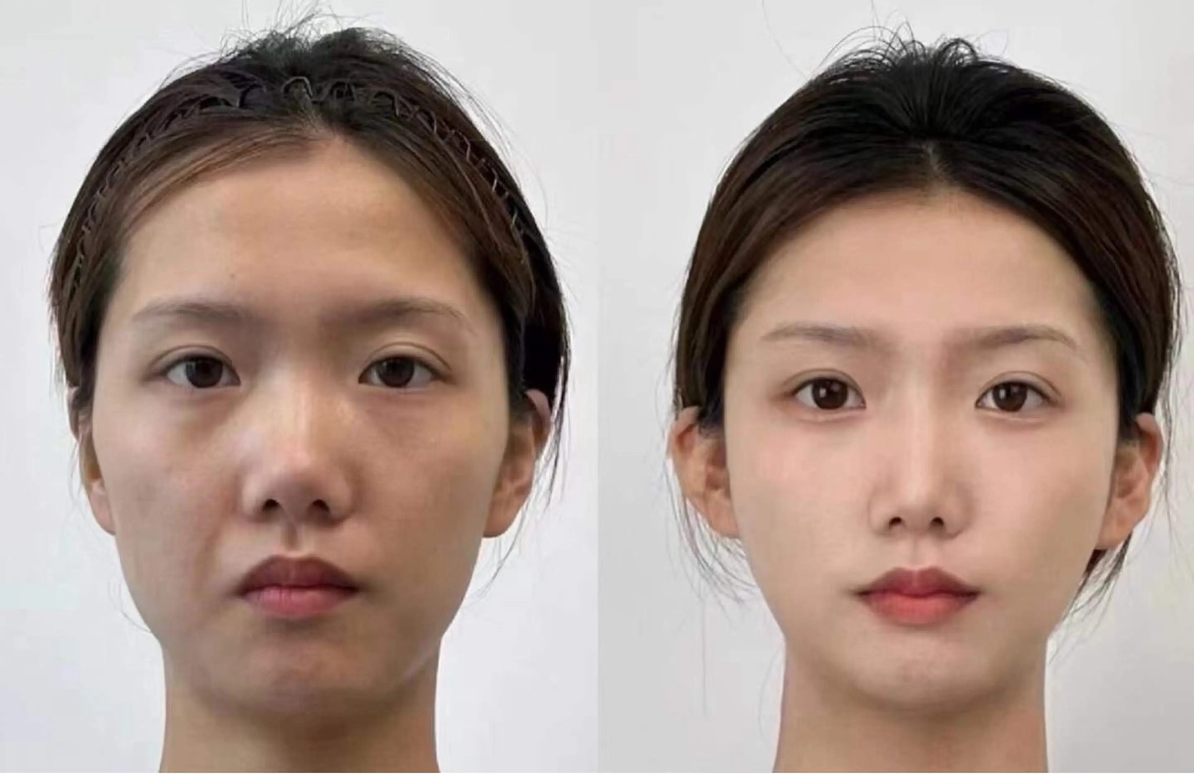 ネイル エステ aliaハーブ水光店 エステティシャン募集のエステ・リラクイメージ