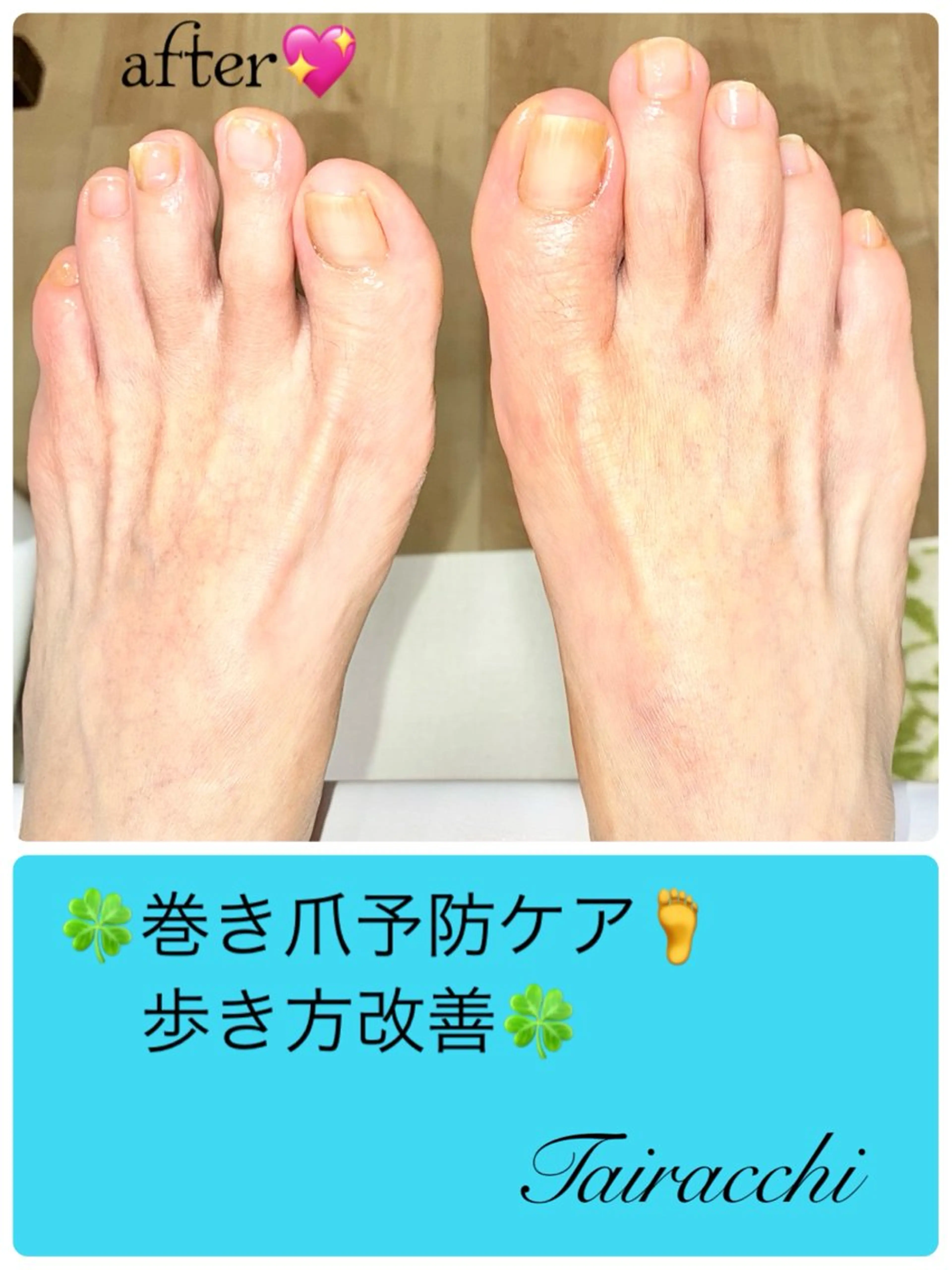 ネイル フットネイル フットネイル Tairacchi ﾀｲﾗｯﾁのエステ・リラクイメージ
