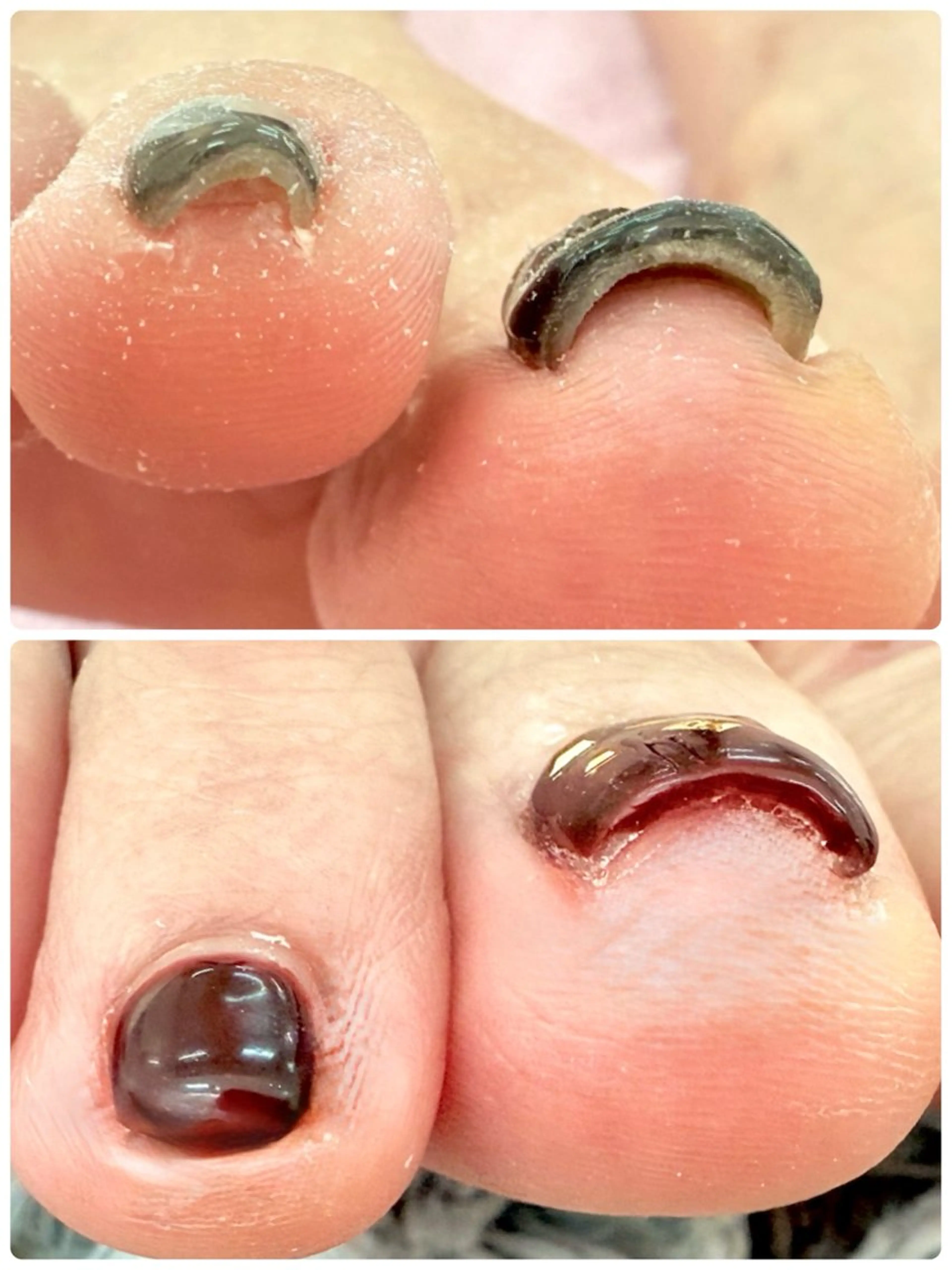 ネイル モナネイル ＡＩのネイルデザイン
