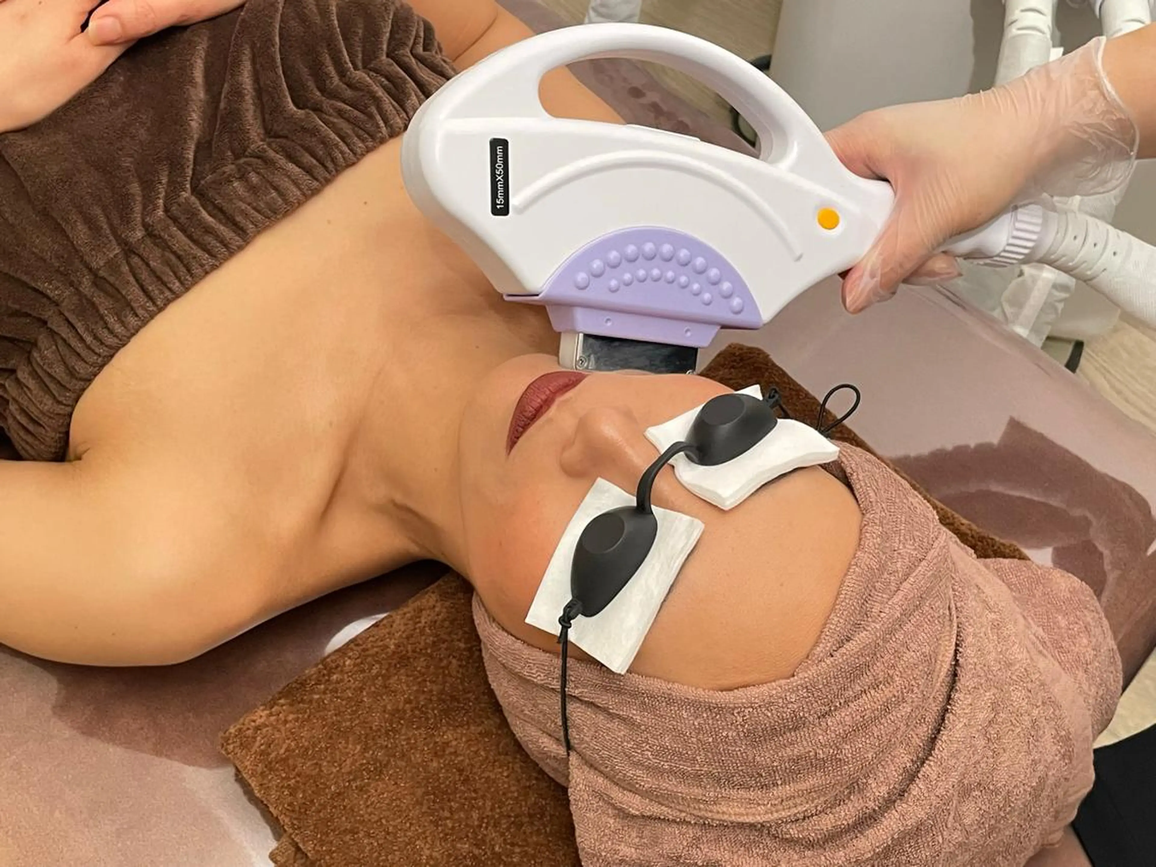 くすみも改善!化粧ノリUP!お顔脱毛の写真