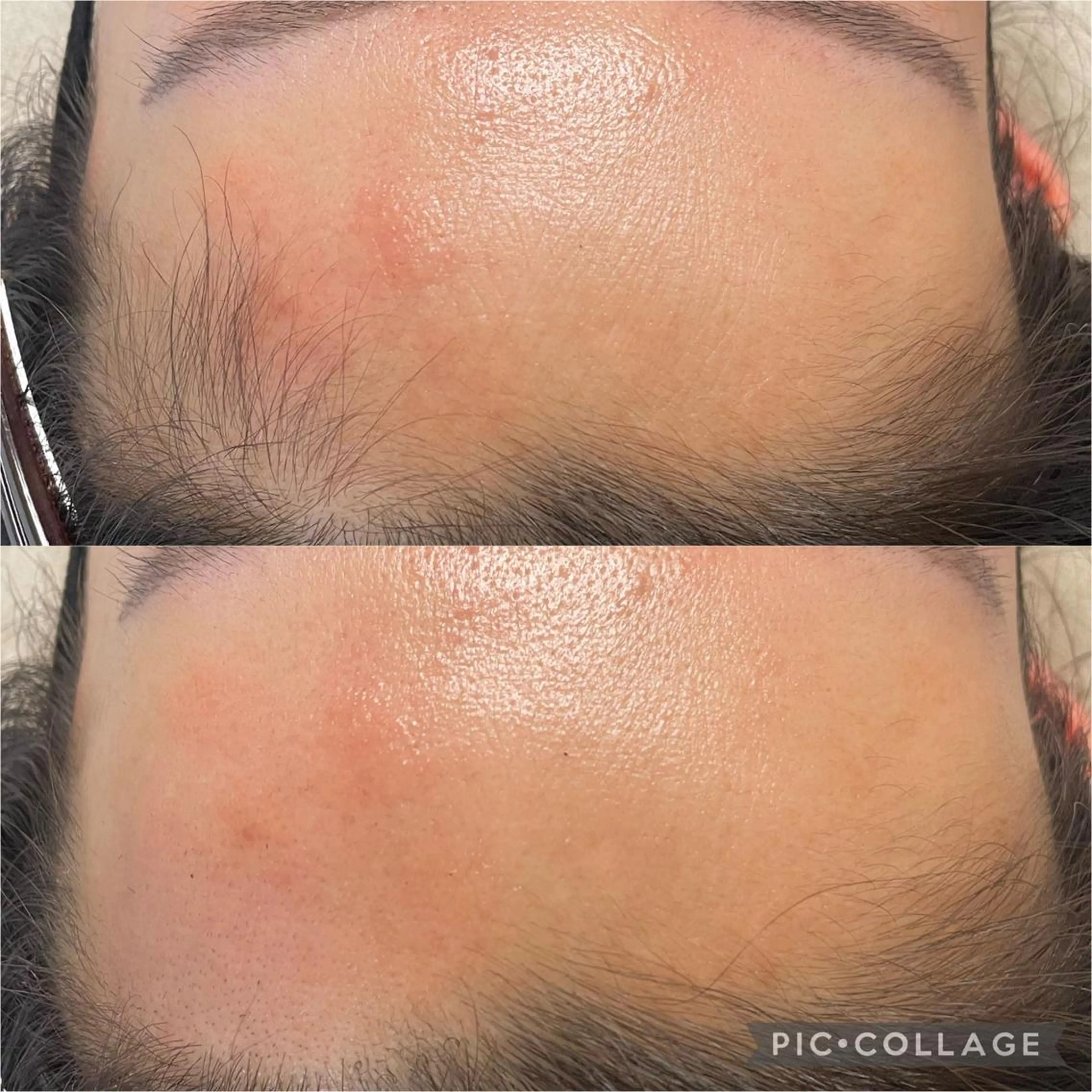 毛穴レス ハーブ＆ ワックス脱毛×光脱毛のエステ・リラクイメージ