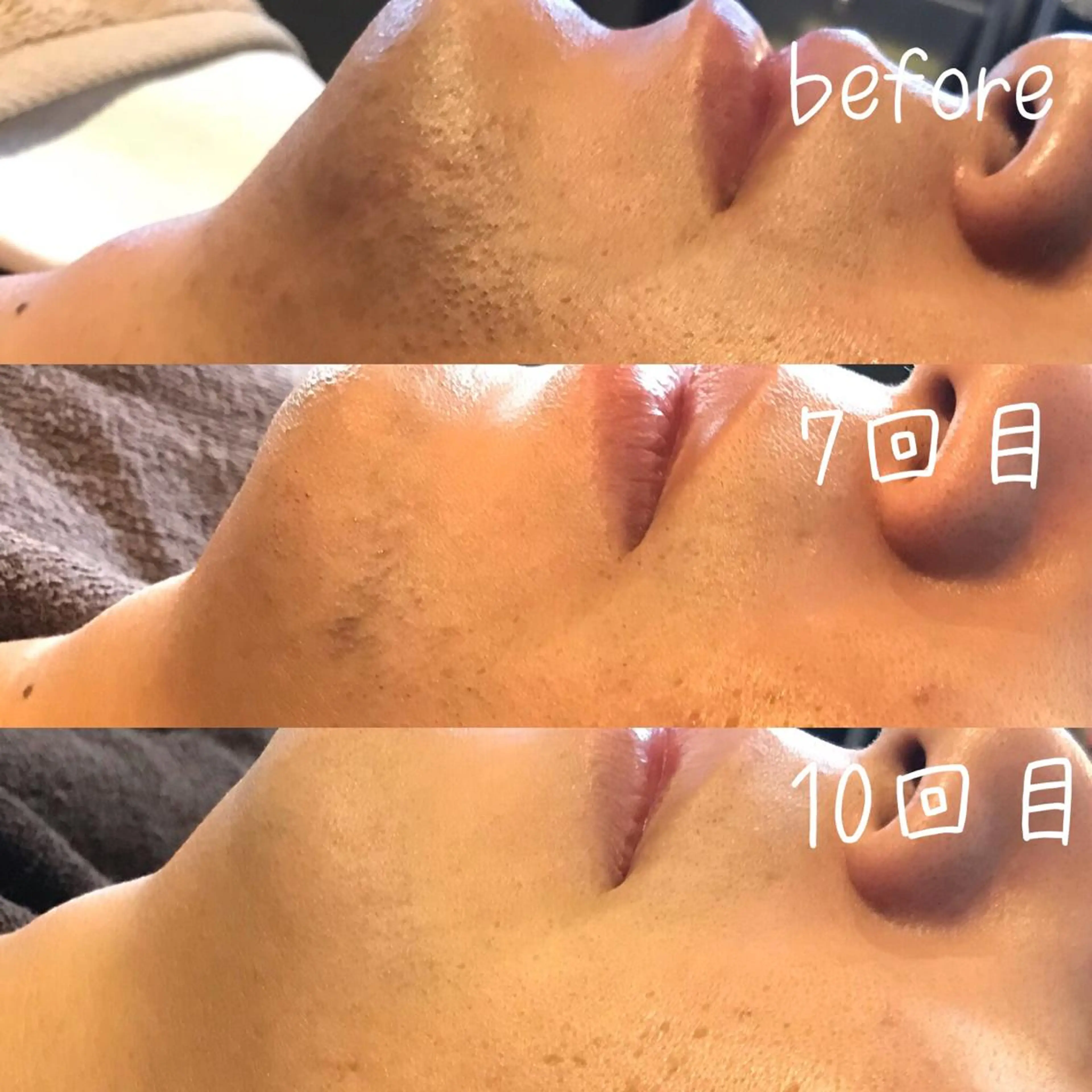 脱毛 浜野 恵美のエステ・リラクイメージ