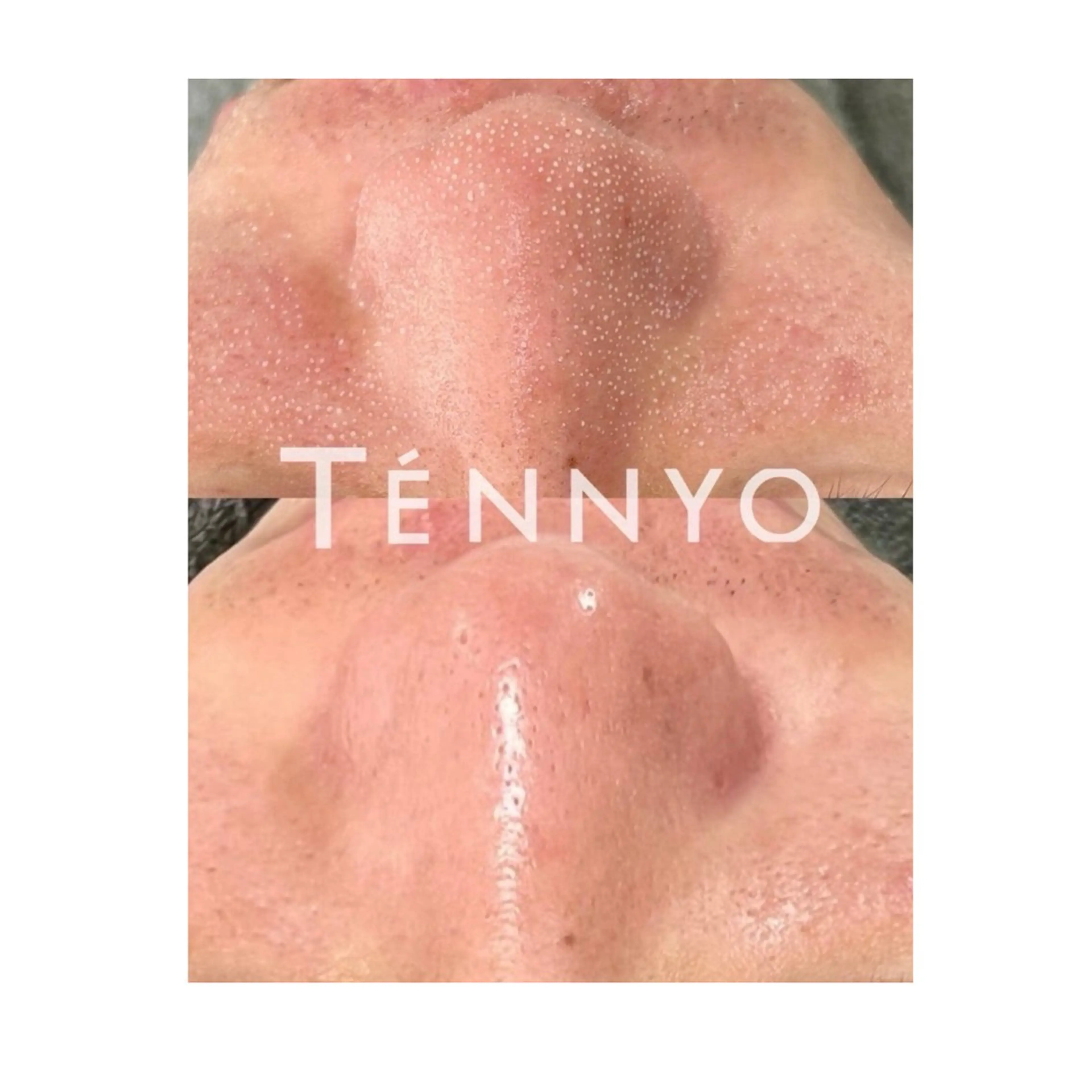 'OLI yukinaのエステ・リラクイメージ