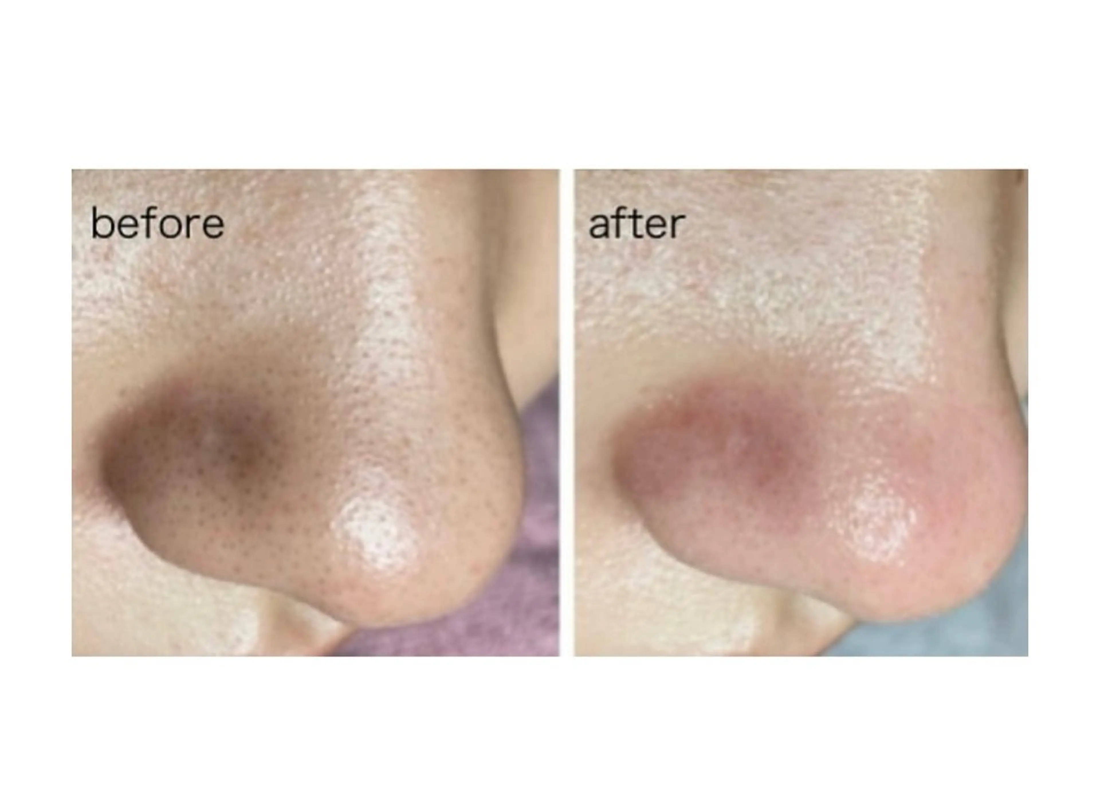 痩身Salon Charmeのエステ・リラクイメージ