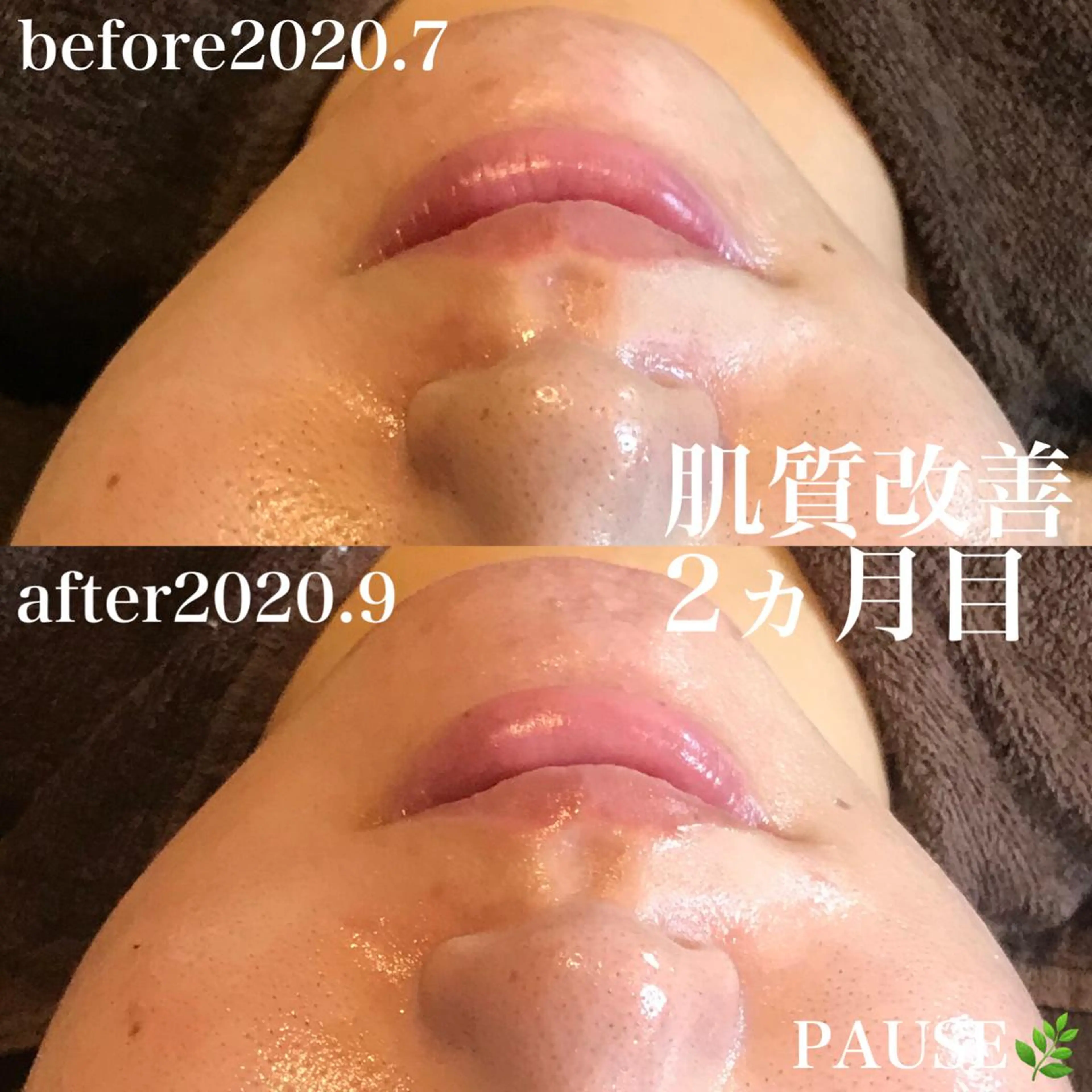 エステ 浜野 恵美のエステ・リラクイメージ