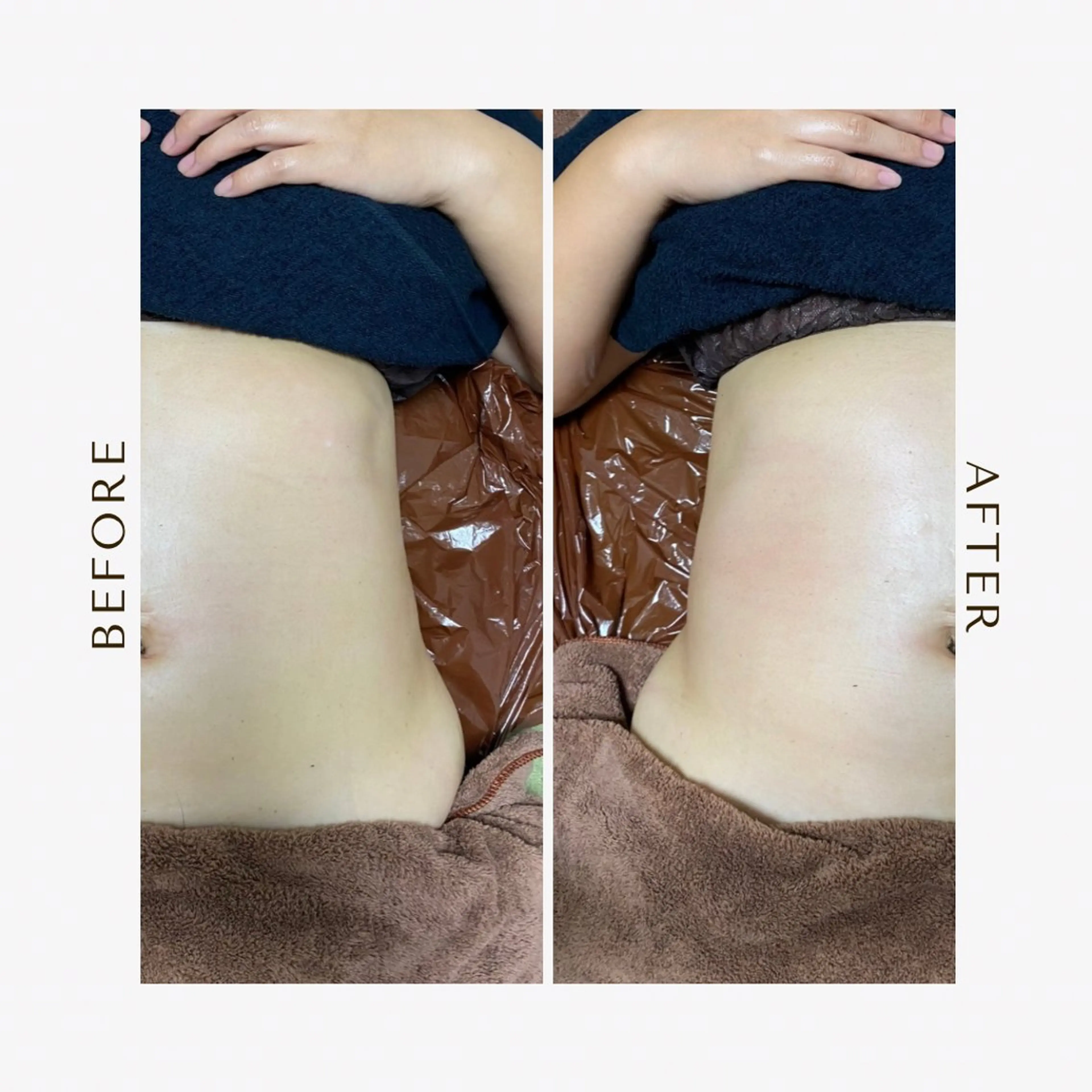 体質改善全身リンパマッサージ:モニター様（ビフォーアフター写真、アンケートにご協力お願いします）の写真