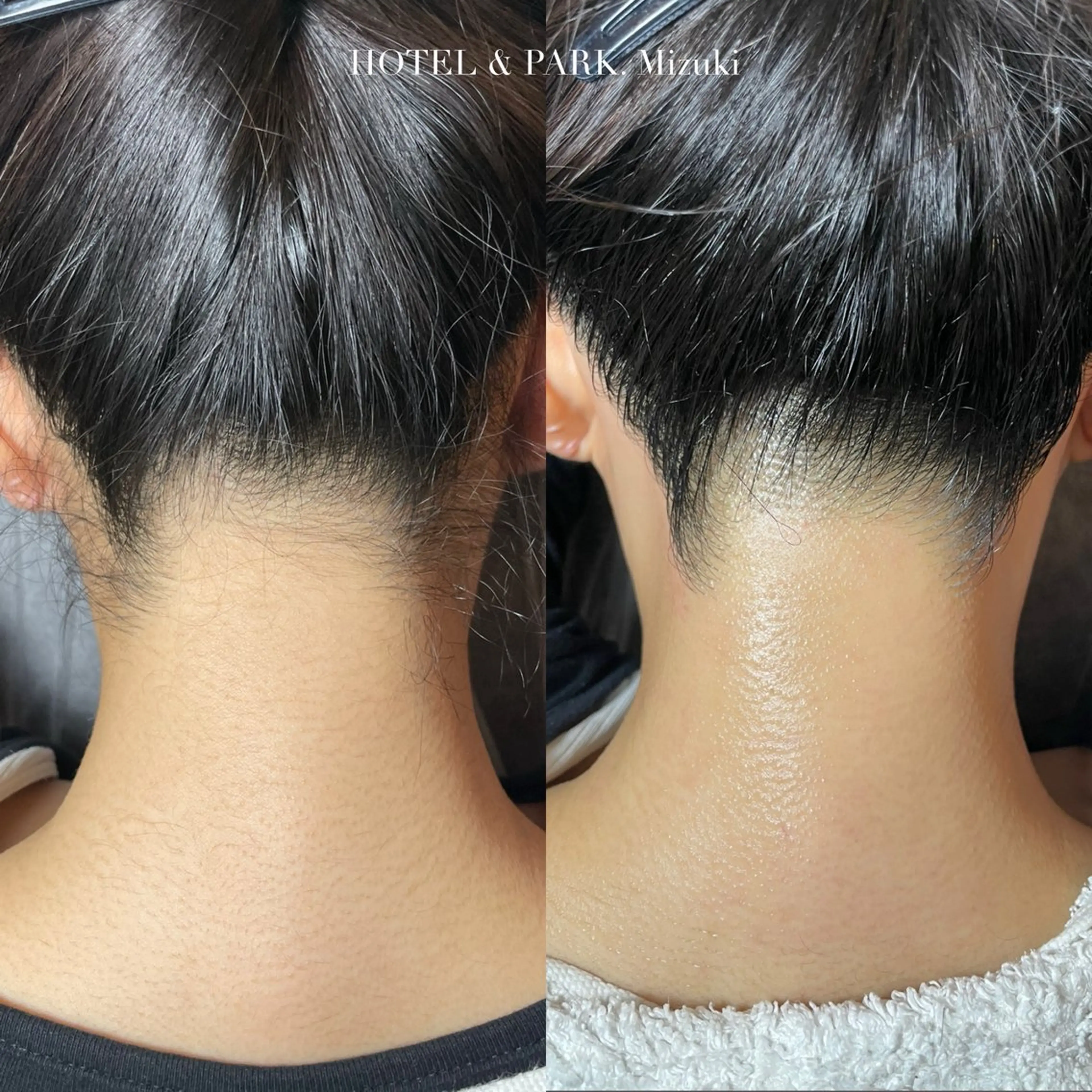 脱毛 HOTEL&PARK . ワックス脱毛のエステ・リラクイメージ