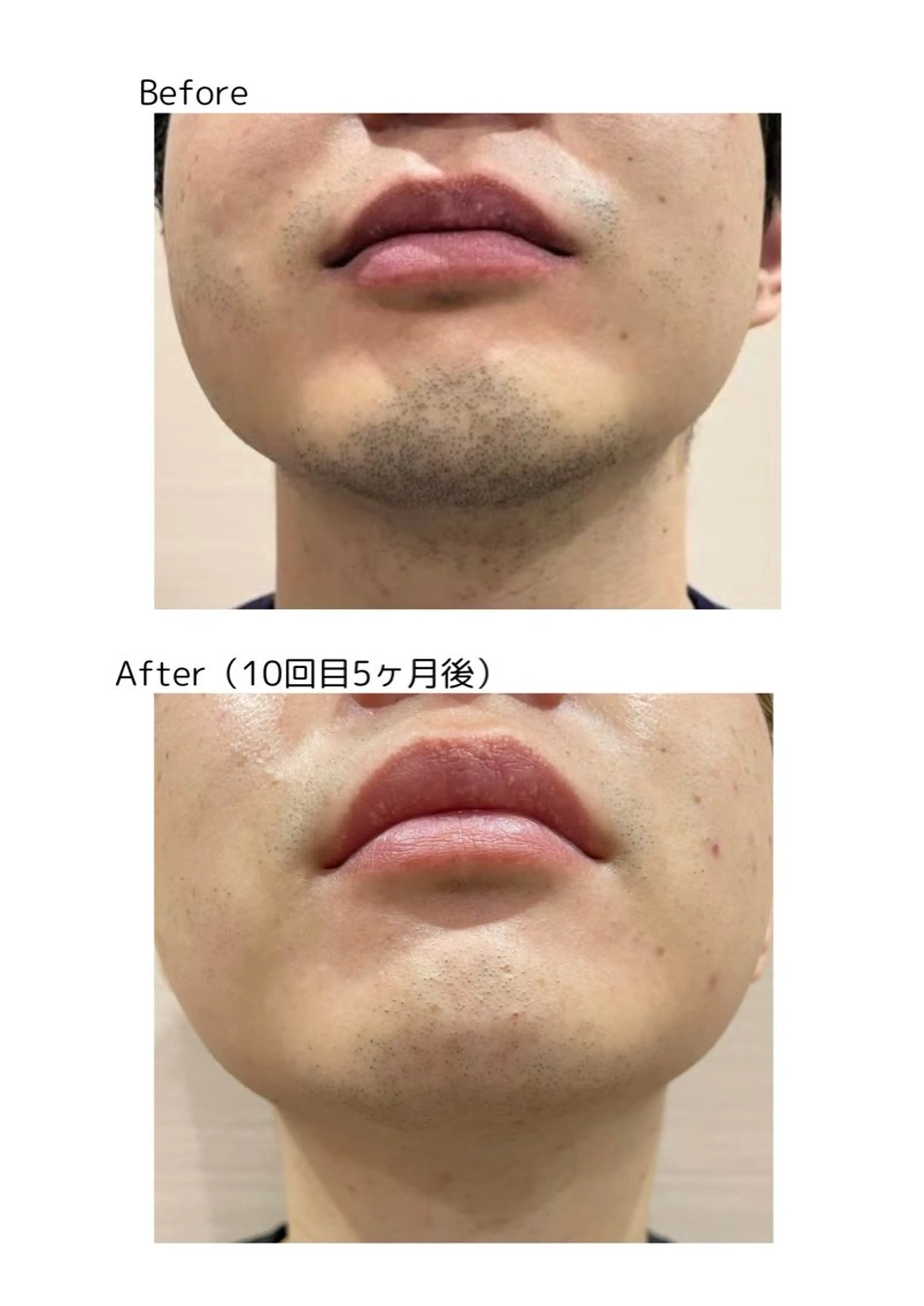 メンズ どいしほ@久屋大通 揉みほぐし・オイルのエステ・リラクイメージ