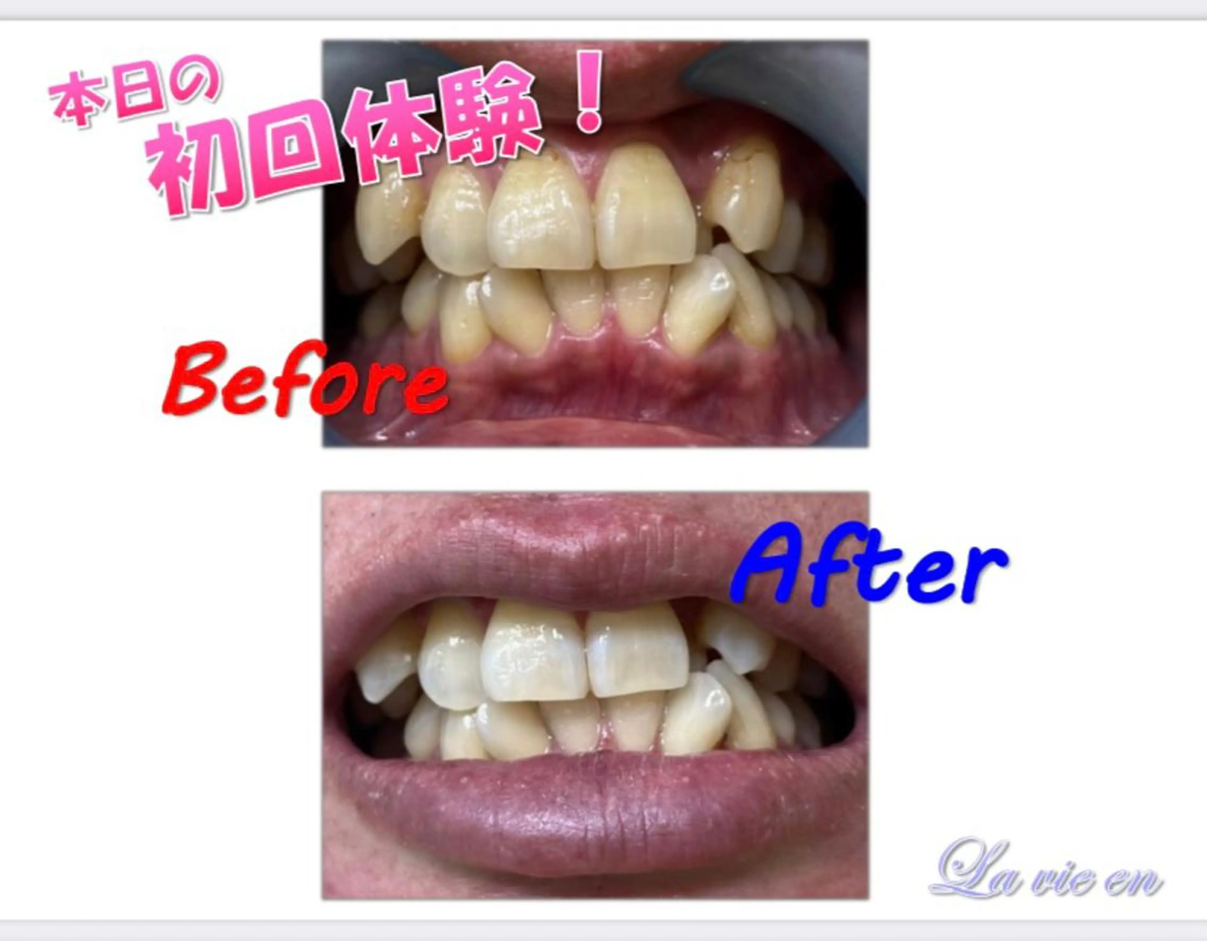 その他 ホワイトニングサロン La vie enのその他イメージ