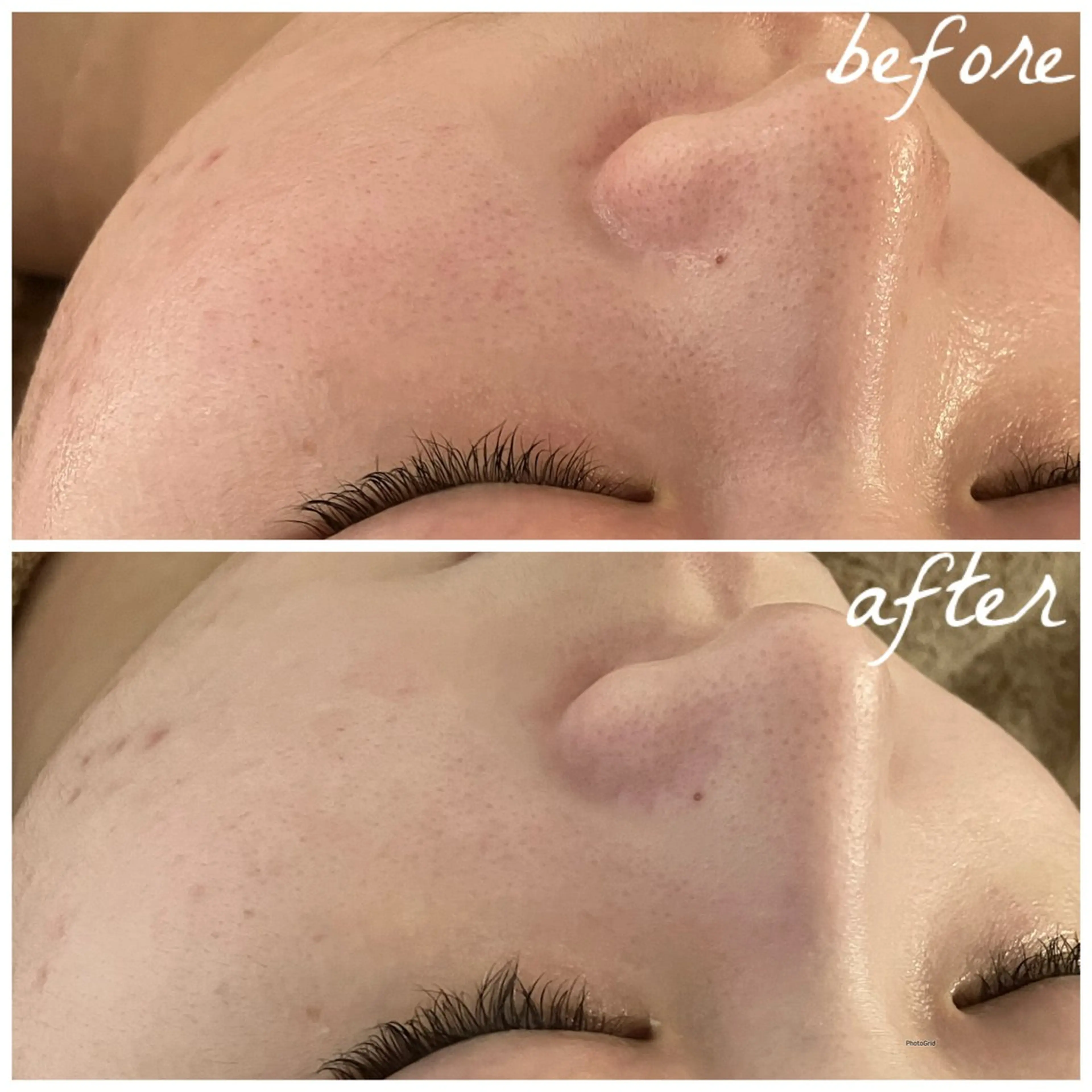 メンズ エステ メナード岐阜市茜部 杉浦のエステ・リラクイメージ