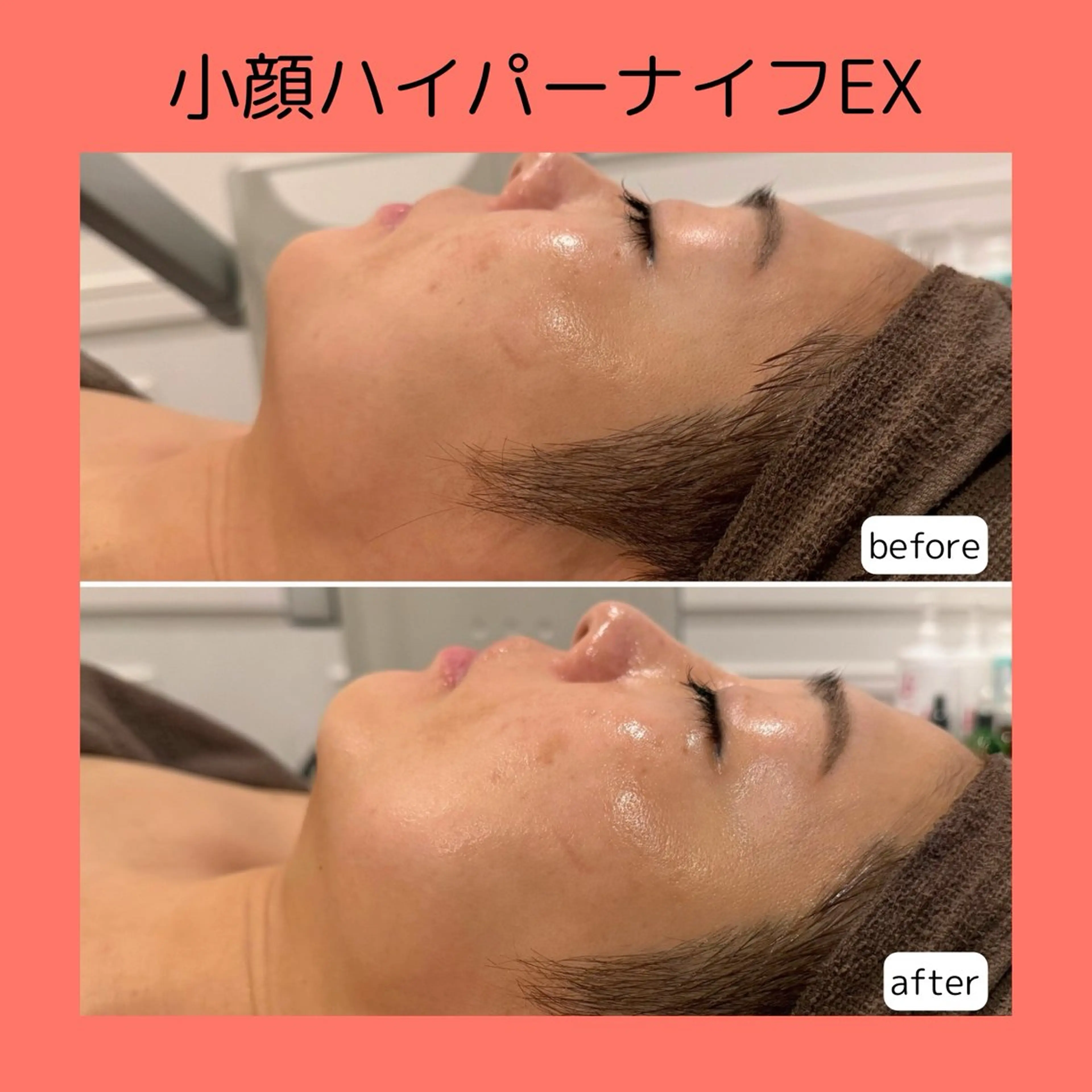 赤澤/本気痩せ・脱毛 ・ノーファンデ肌のエステ・リラクイメージ