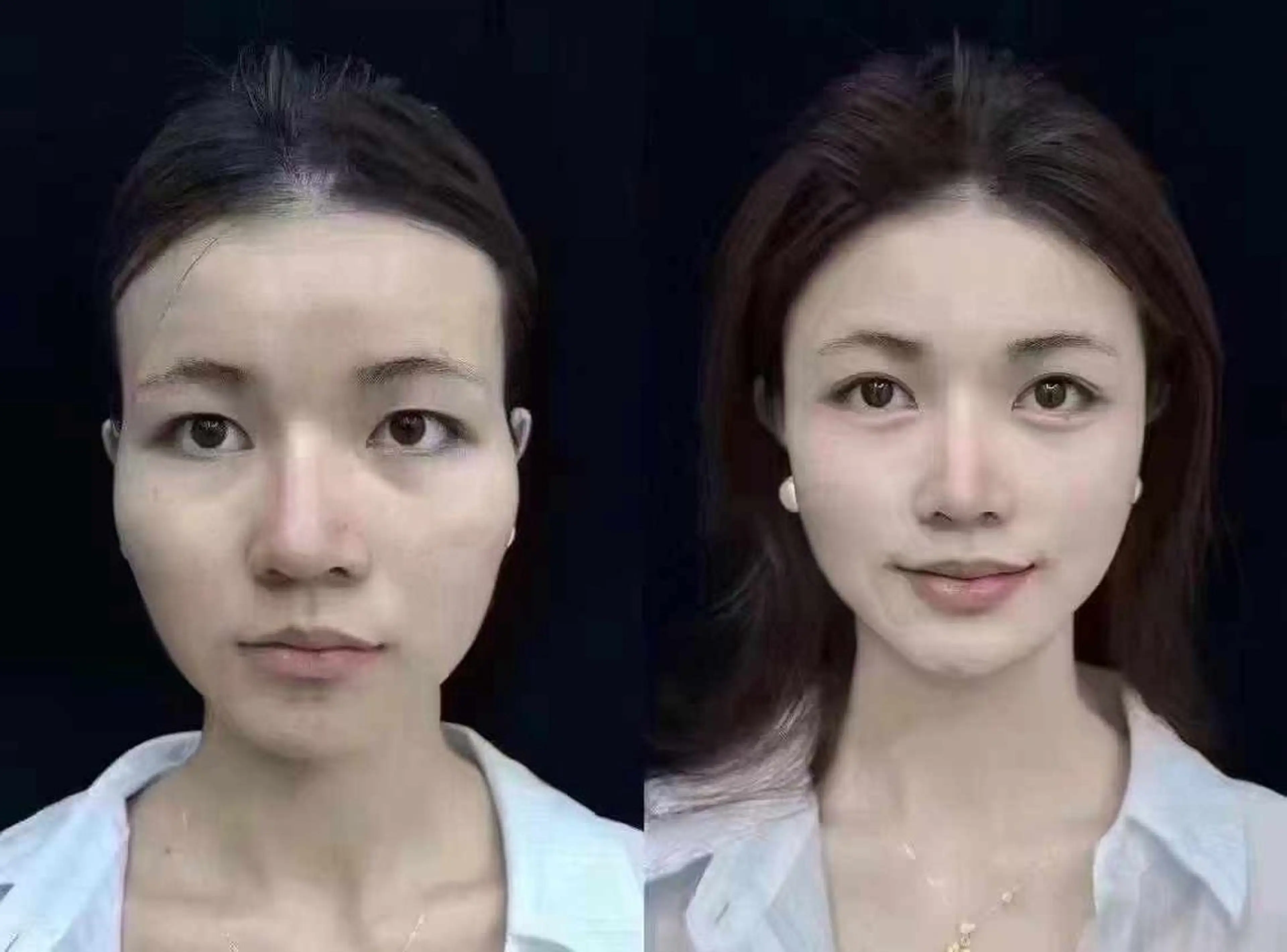 マツエク・マツパ 結婚式・ブライダル エステ aliaハーブ水光店 エステティシャン募集のエステ・リラクイメージ