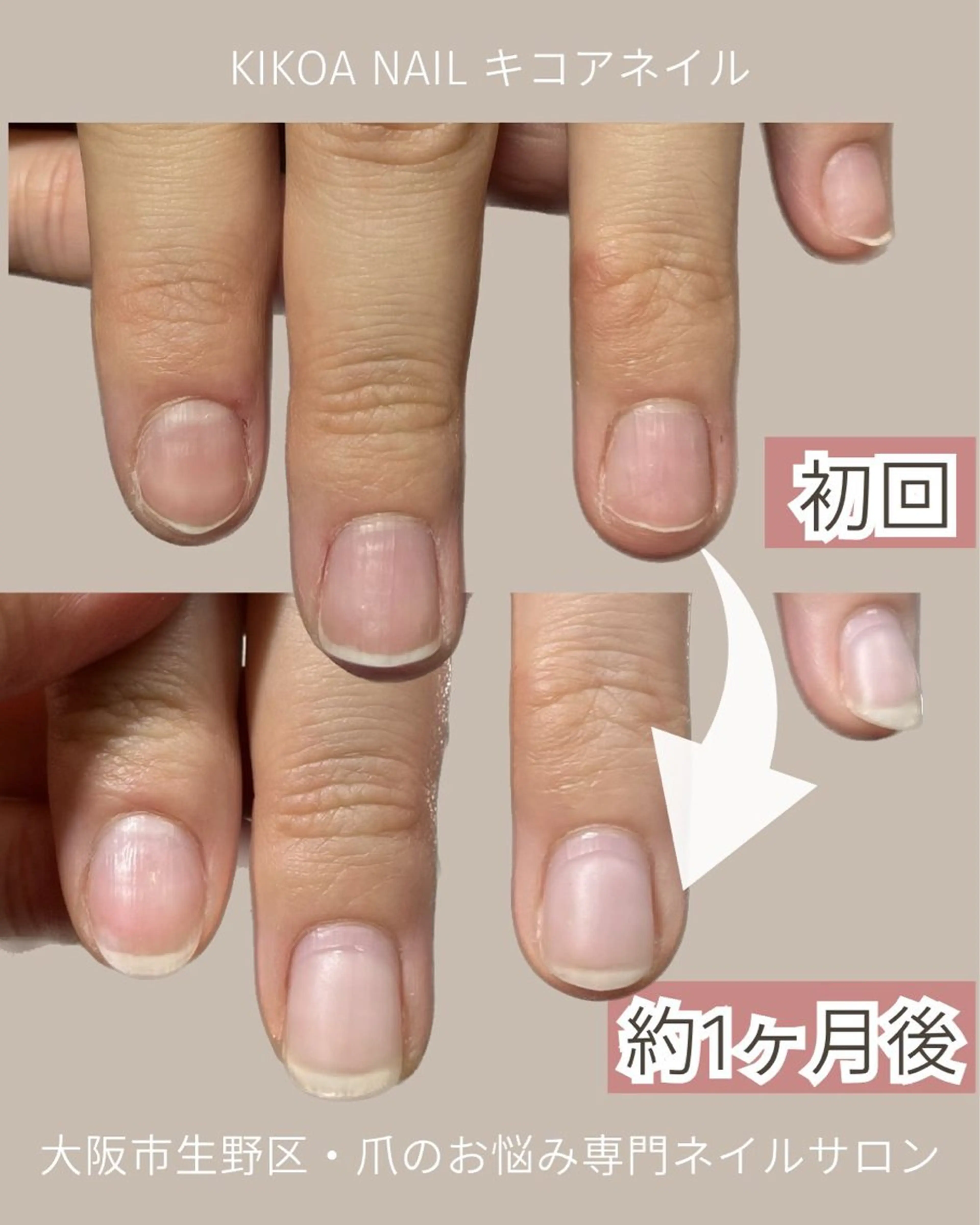 ネイル KIKOA NAIL キコアネイルのネイルデザイン