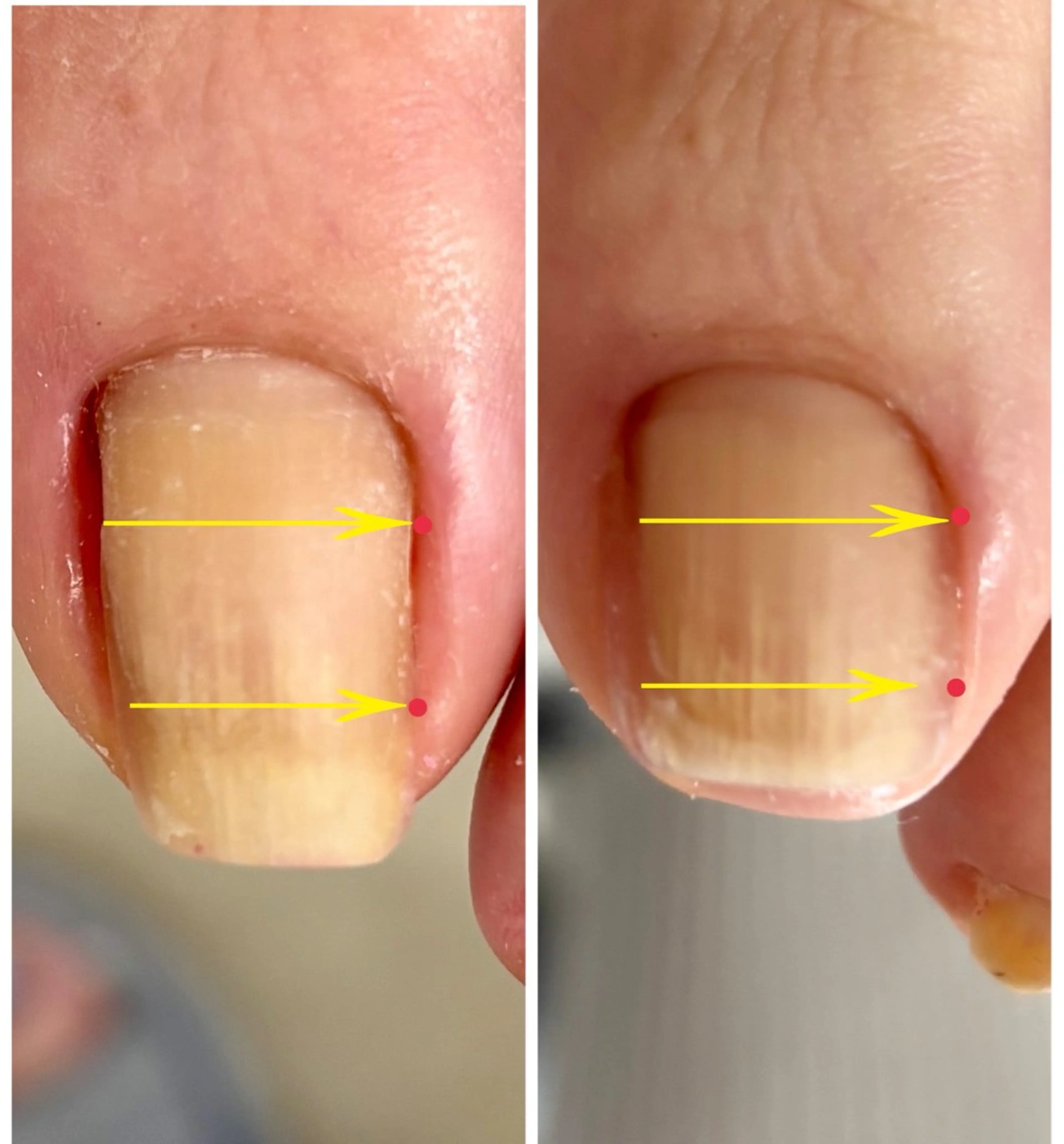 メンズ ネイル 赤色 Chérinail 爪のお手入れのネイルデザイン