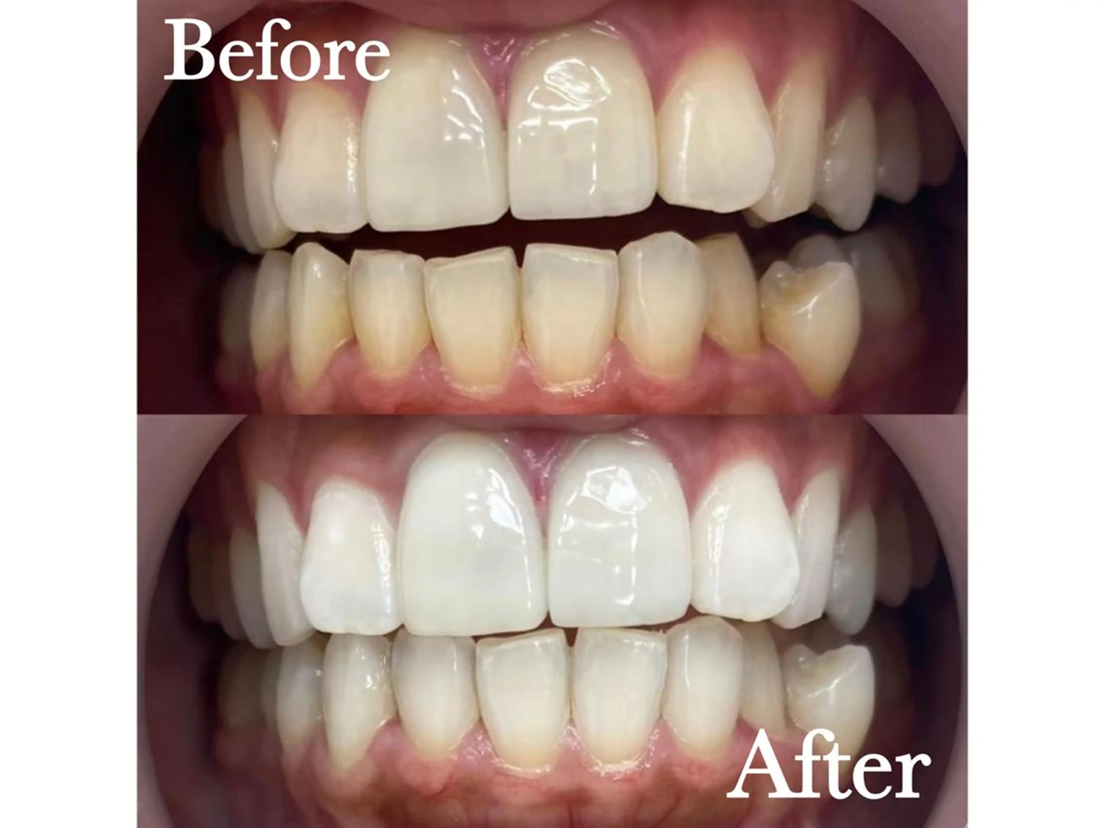 エステ リラク LBSホワイトニング 🌐渋谷店 公式のエステ・リラクイメージ