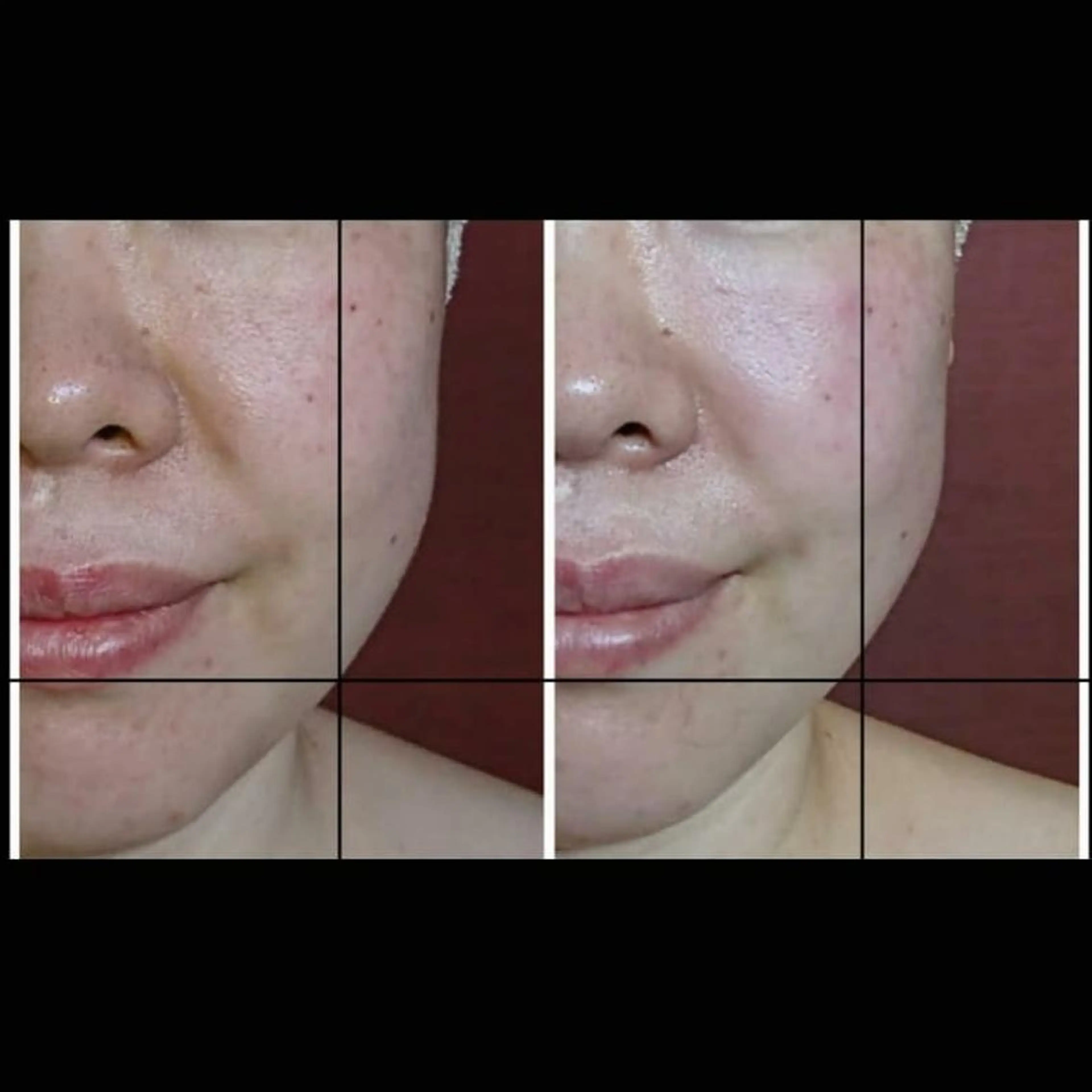 エステ リラク Nako  ﾅｺのエステ・リラクイメージ