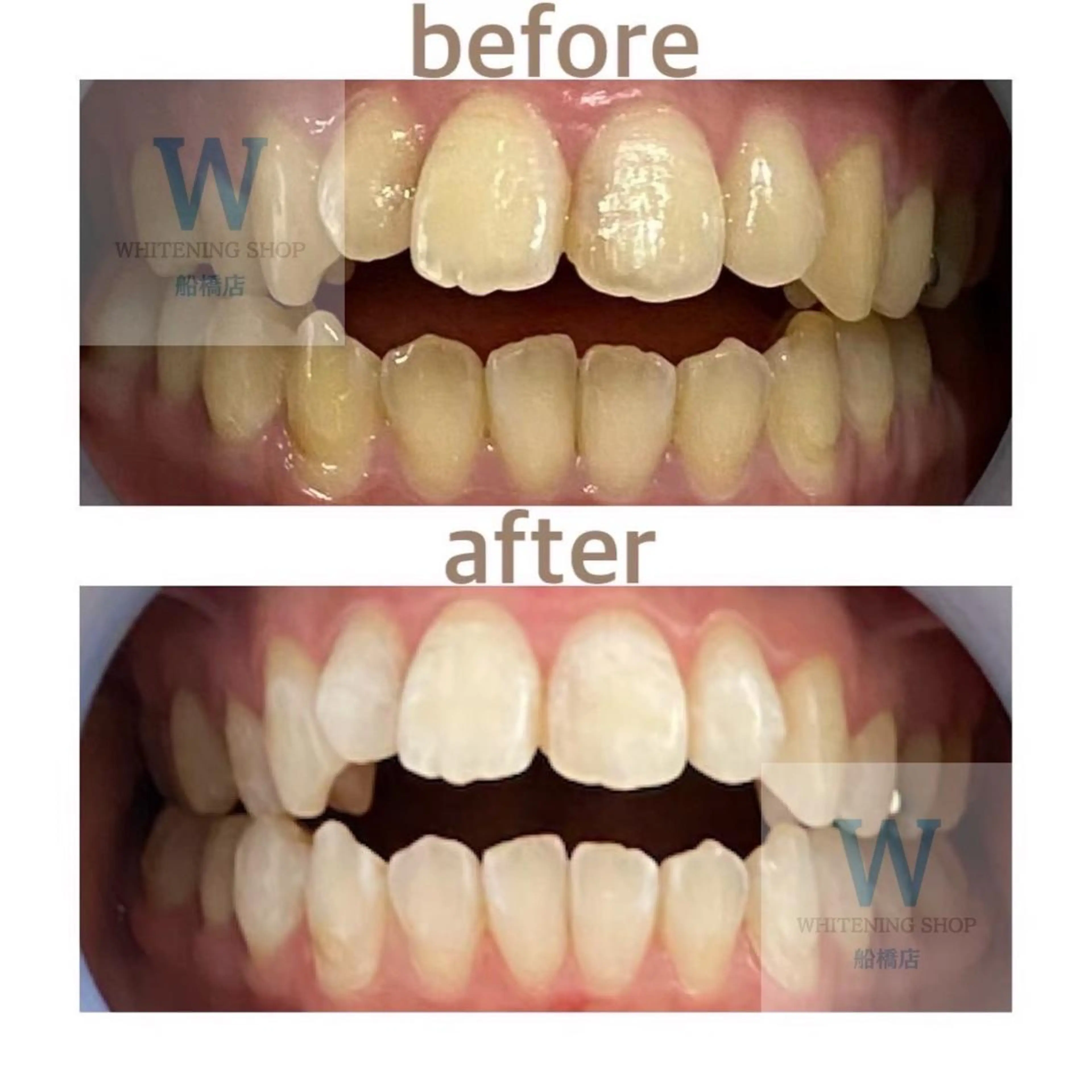 エステ リラク ホワイトニング ショップ船橋店🦷のエステ・リラクイメージ