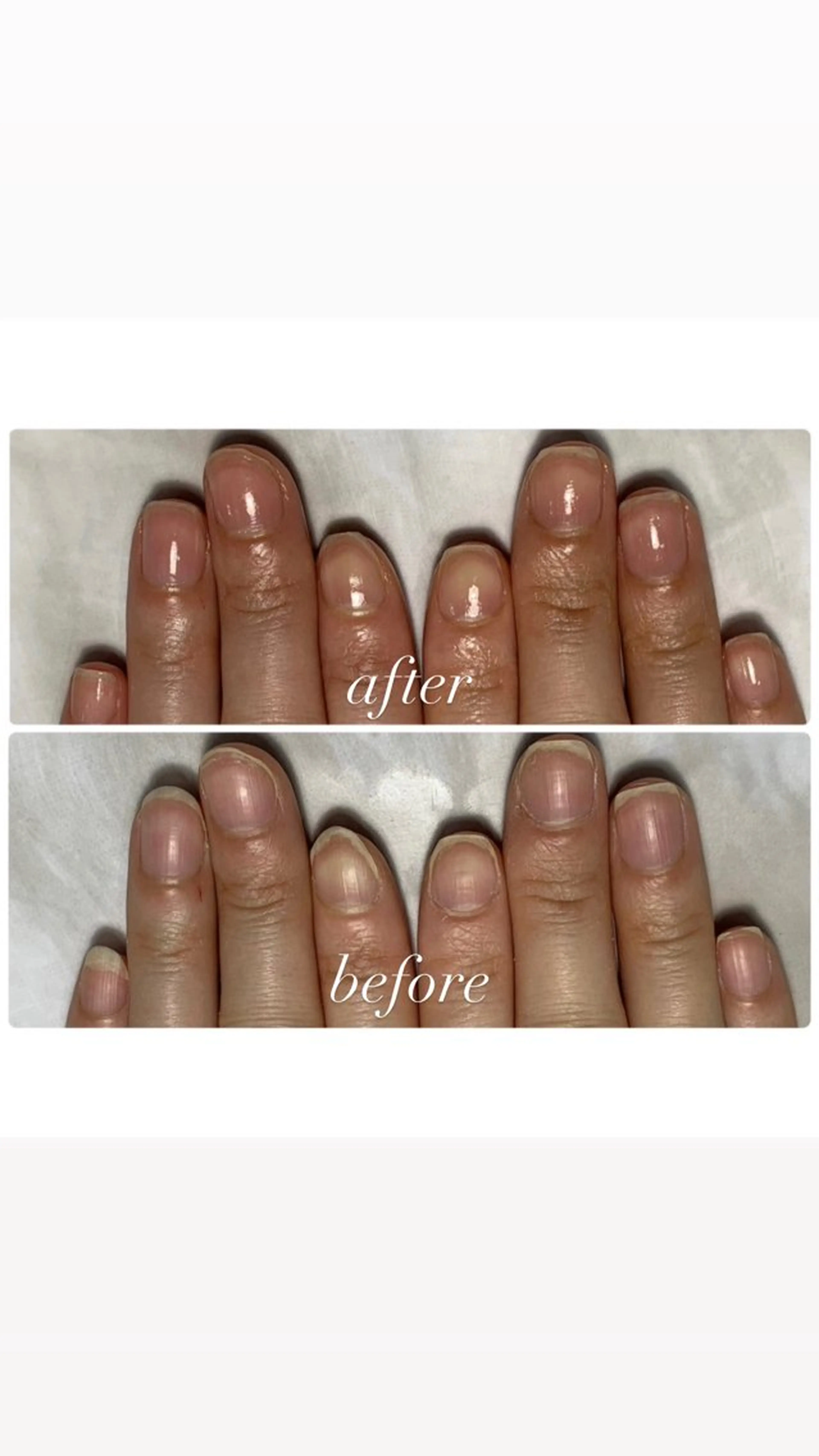 自爪育成(ジェルあり)単品の写真