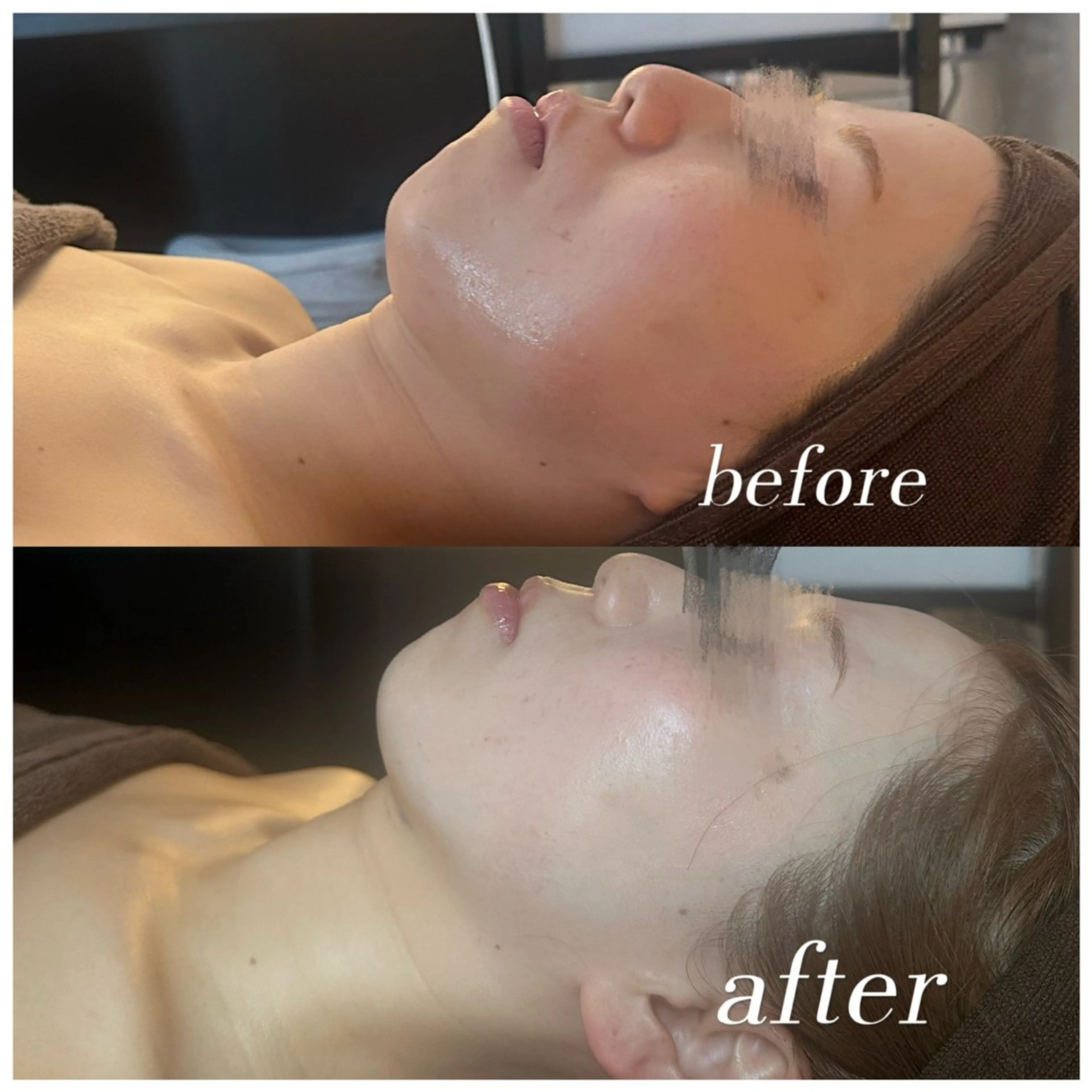 エステ リラク 浮腫|肩こり|張り 日々の疲れを解消★のエステ・リラクイメージ