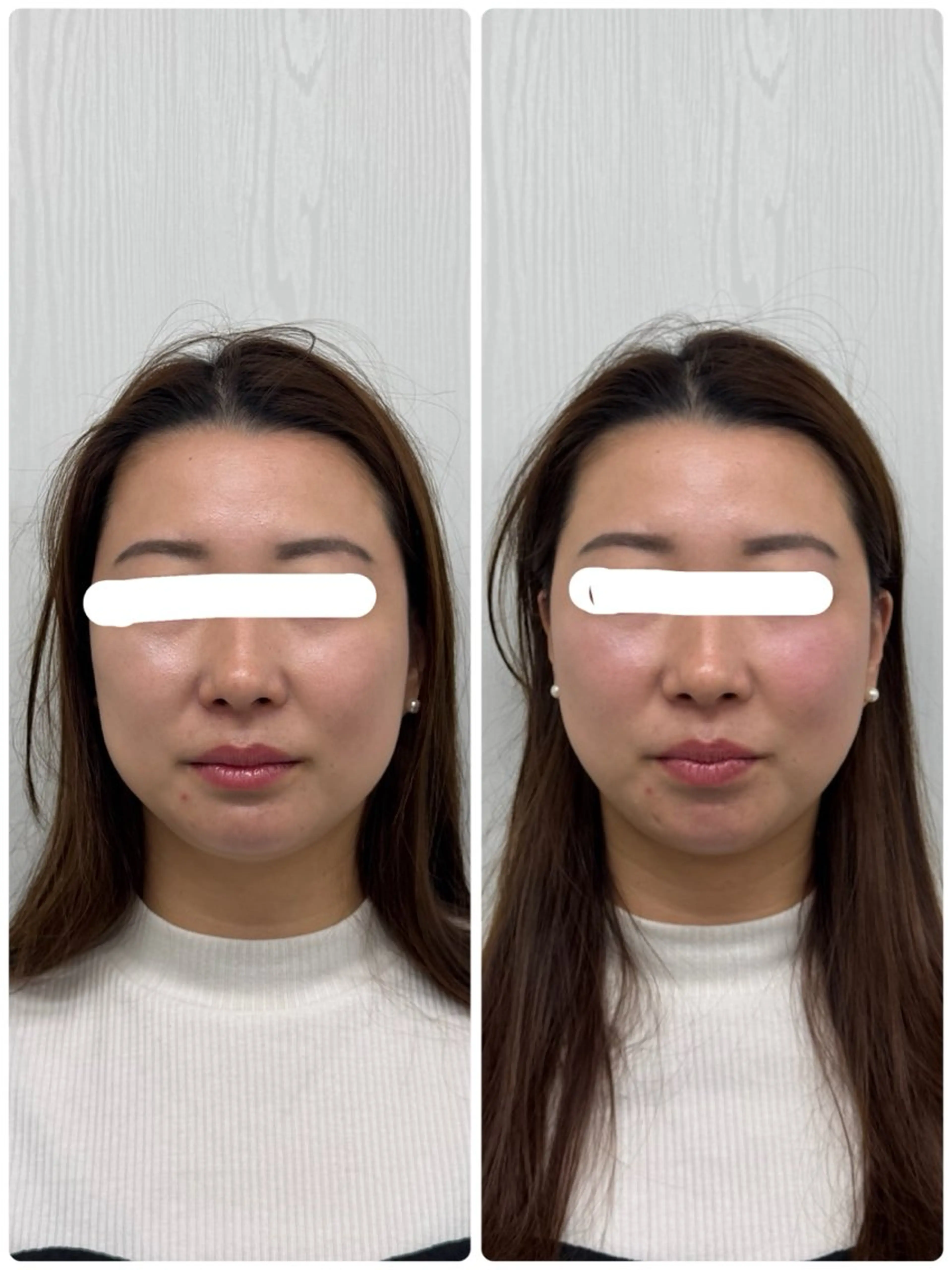 エステ リラク 美容鍼×小顔矯正 ×美容整体　浜川泰仁のエステ・リラクイメージ