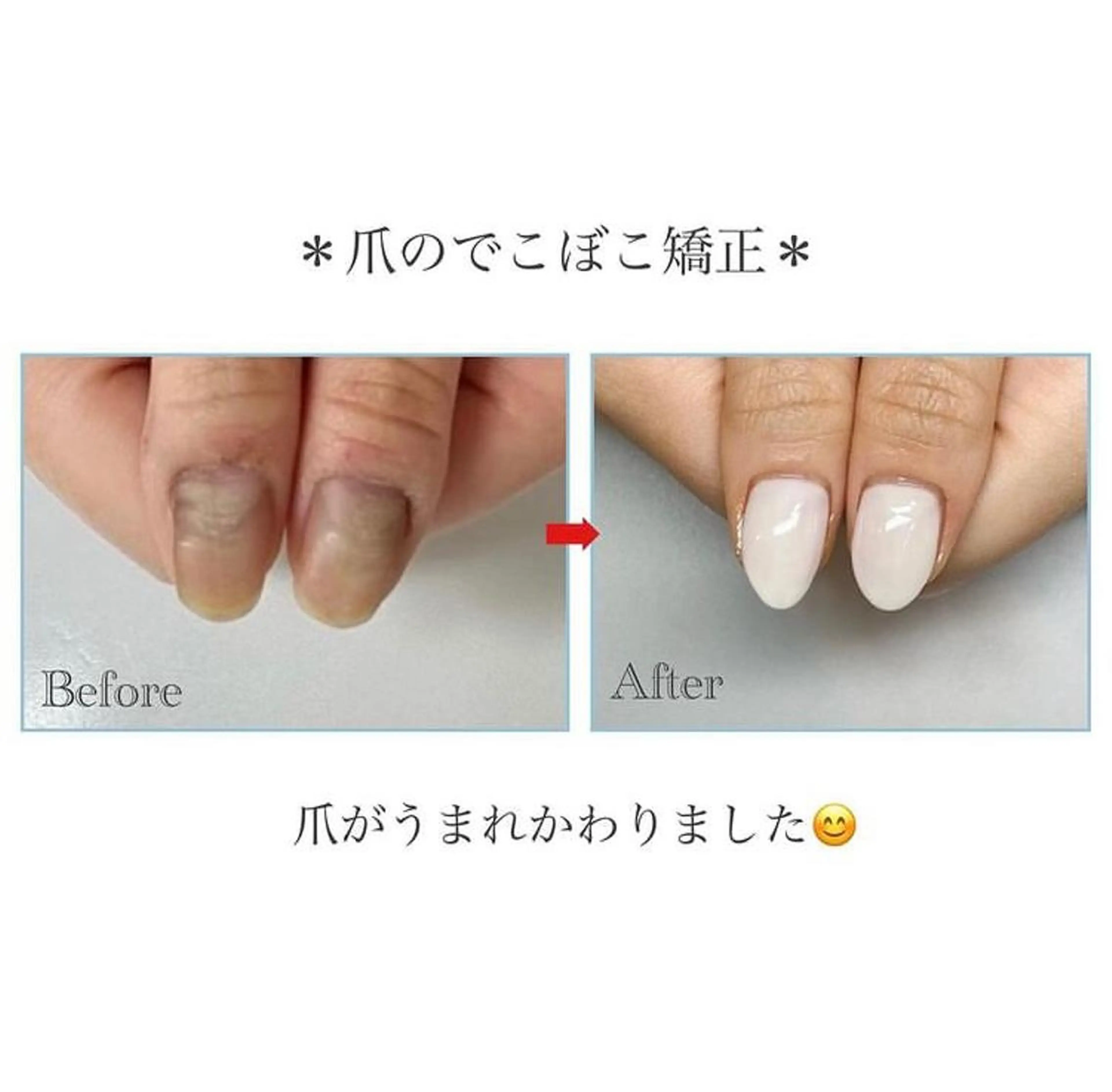 ネイル ネイルサロン アリュームのネイルデザイン