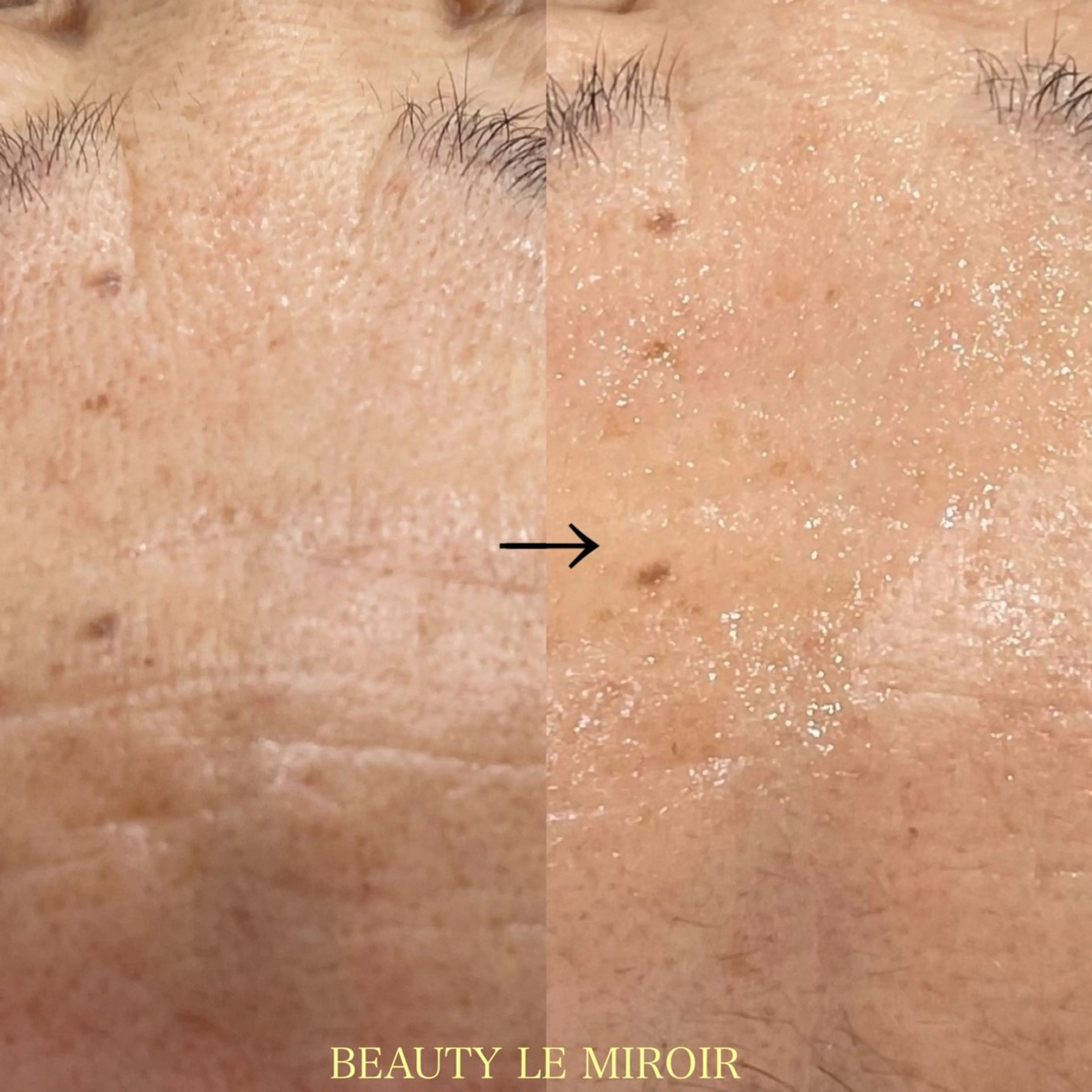 エステ ビューティー ミロワールのエステ・リラクイメージ