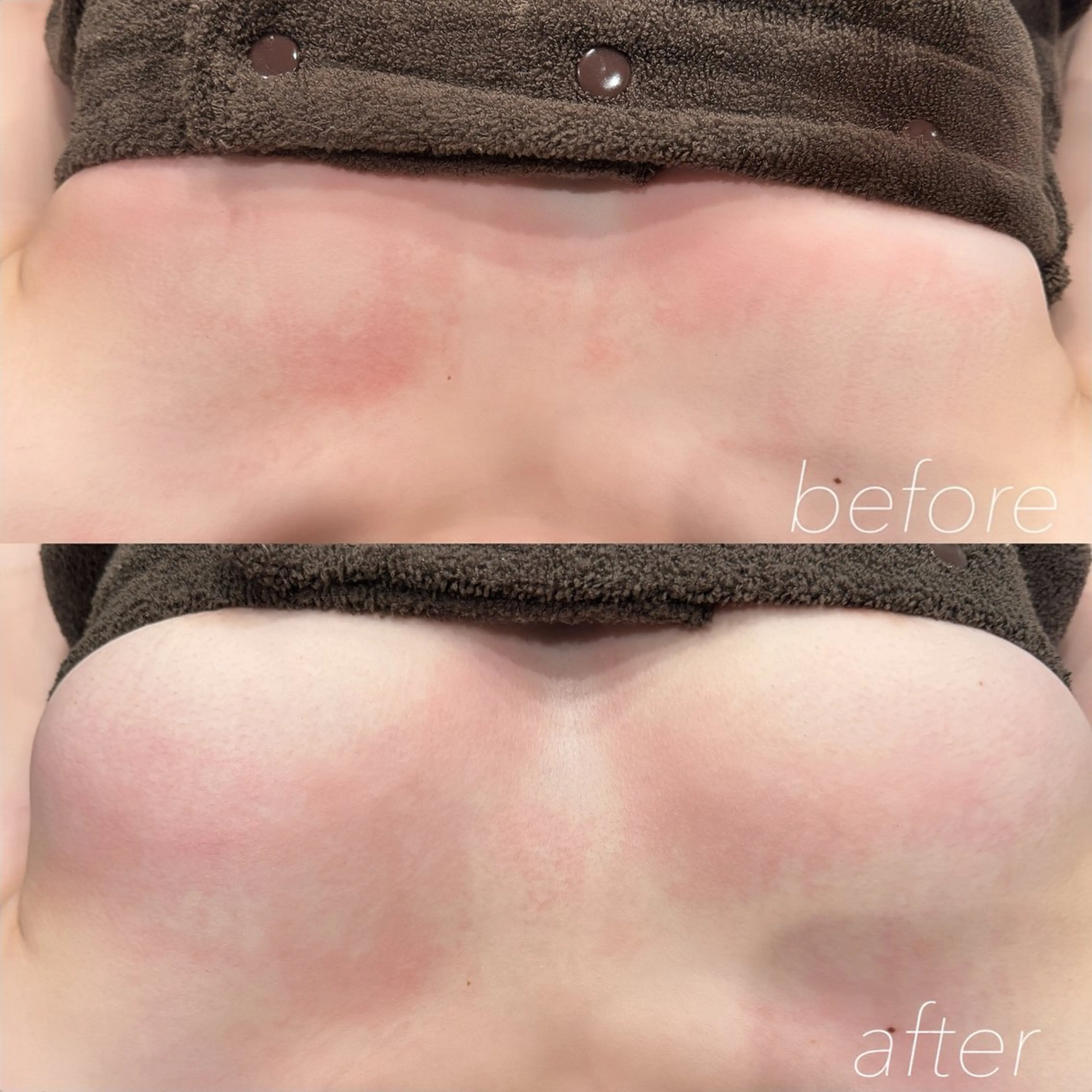 エステ リラク Liberty.f ⌇のその他イメージ