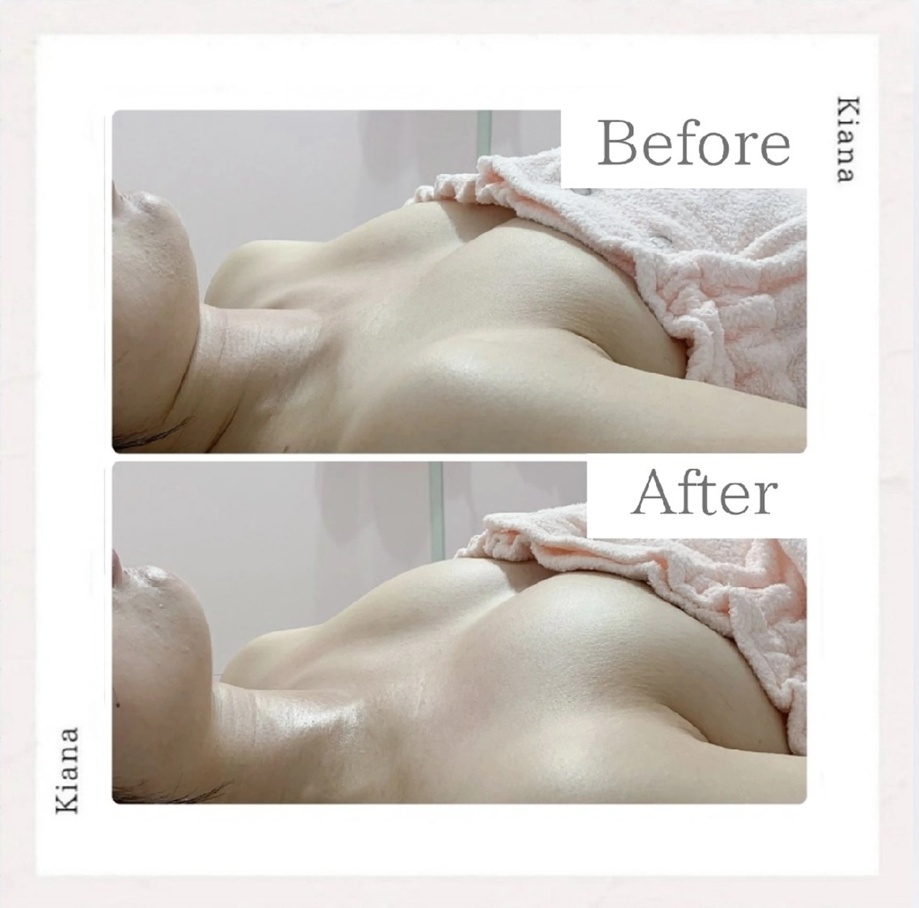 エステ リラク 【バスト専門店 】 Kiana のエステ・リラクイメージ