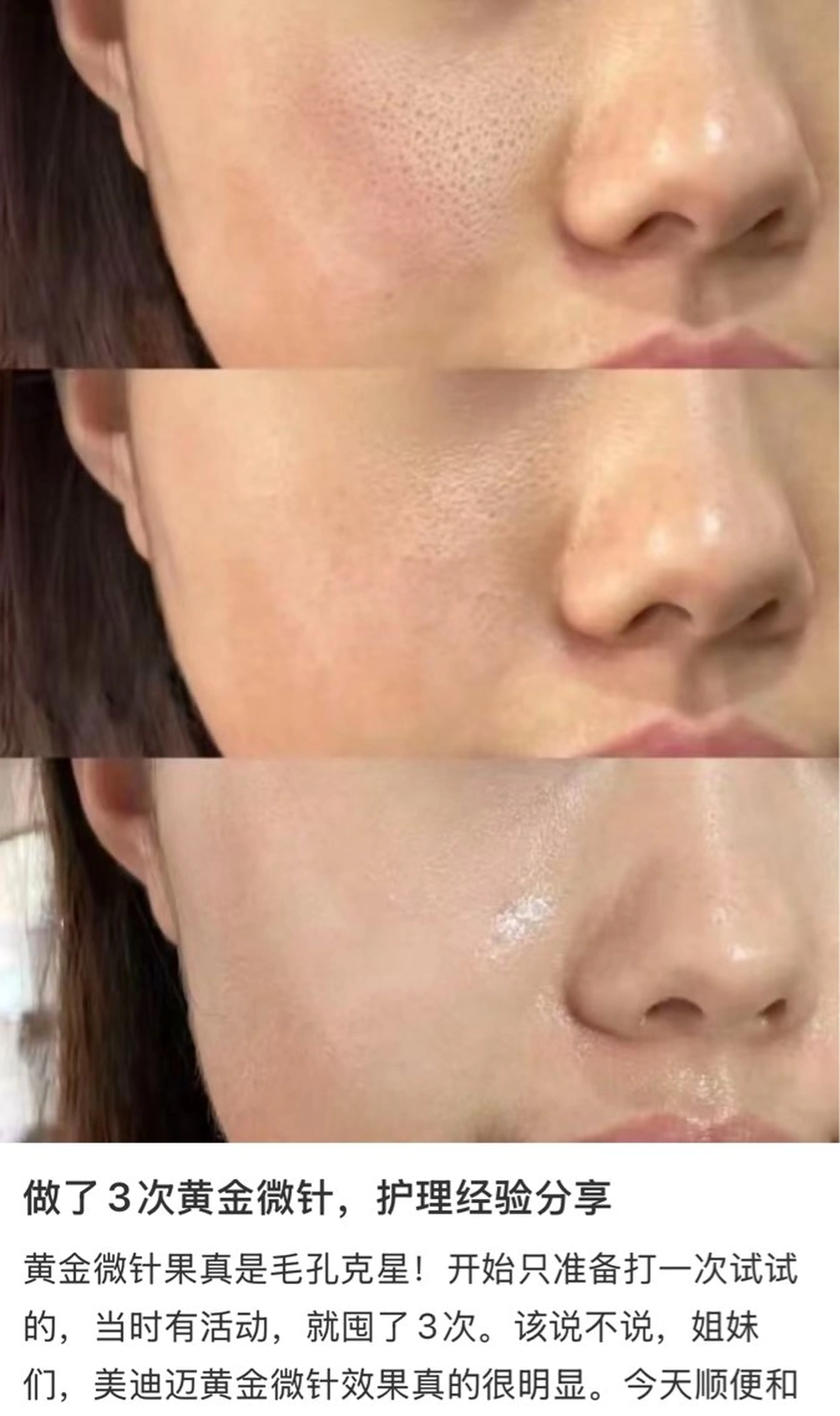 マツエク・マツパ aliaハーブ水光店 エステティシャン募集のエステ・リラクイメージ